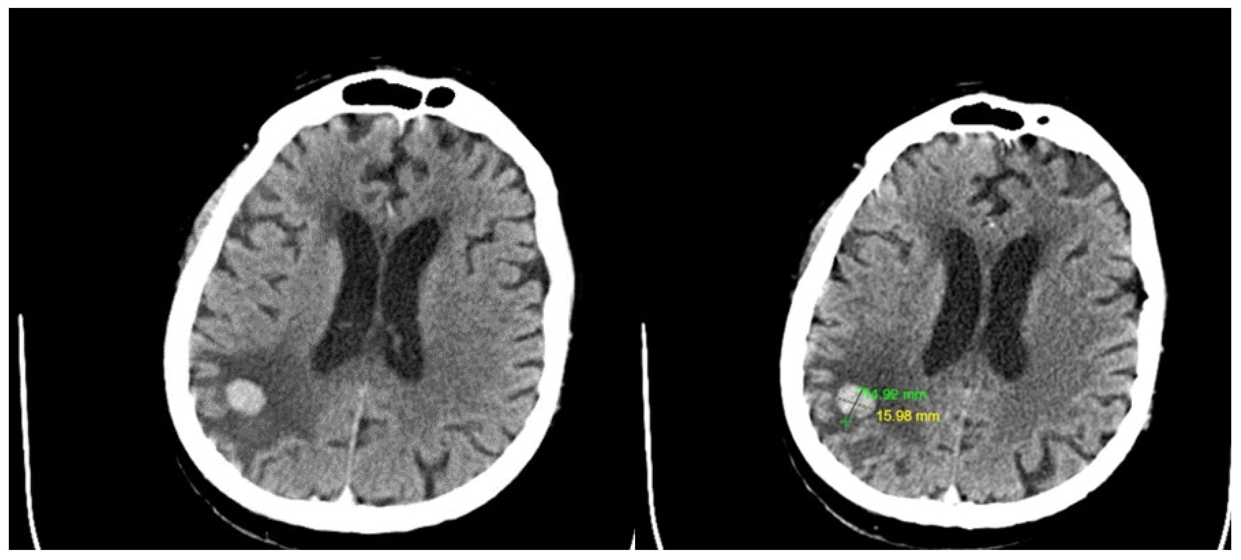 Curroncol 31 00491 g006