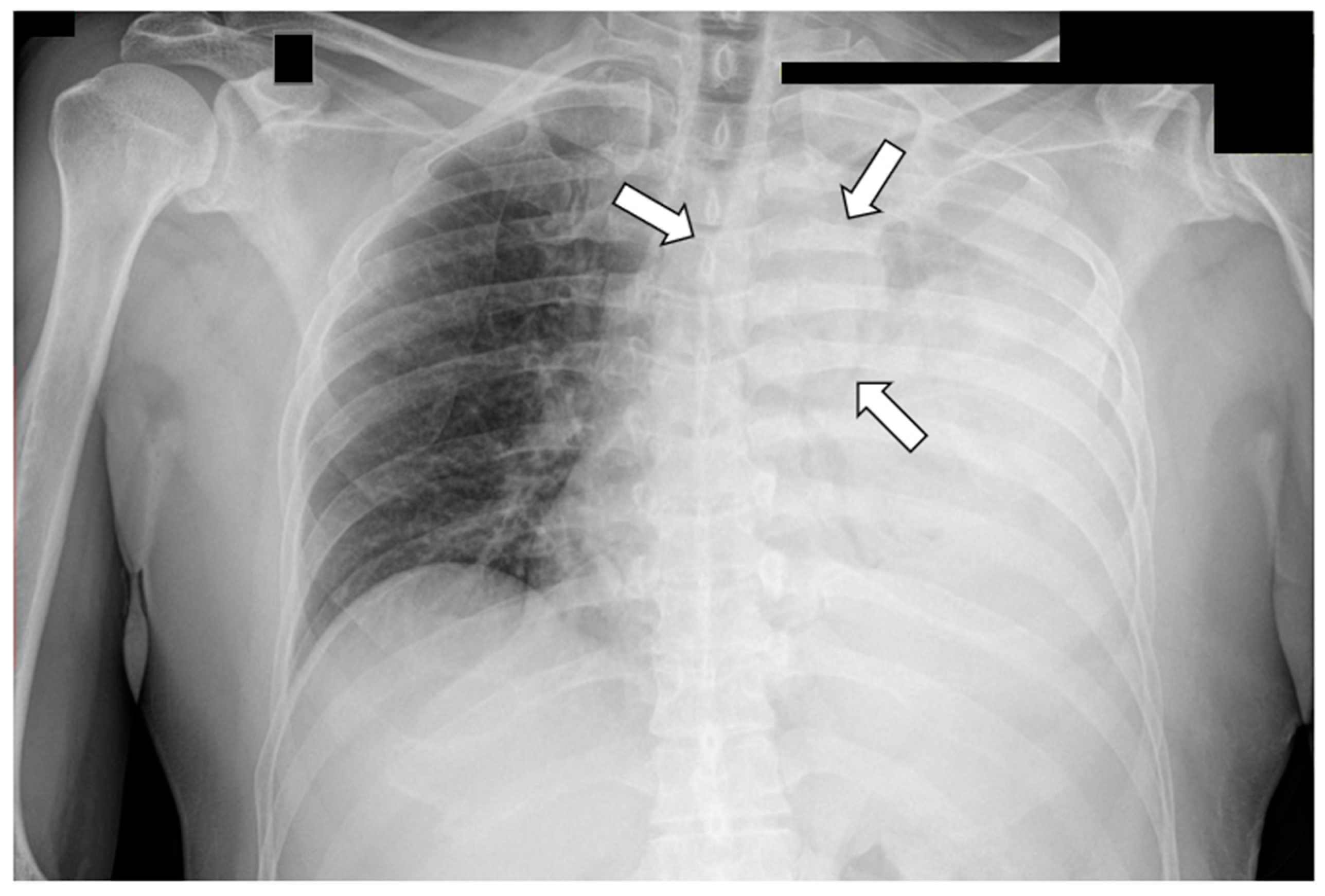 Curroncol 31 00510 g002