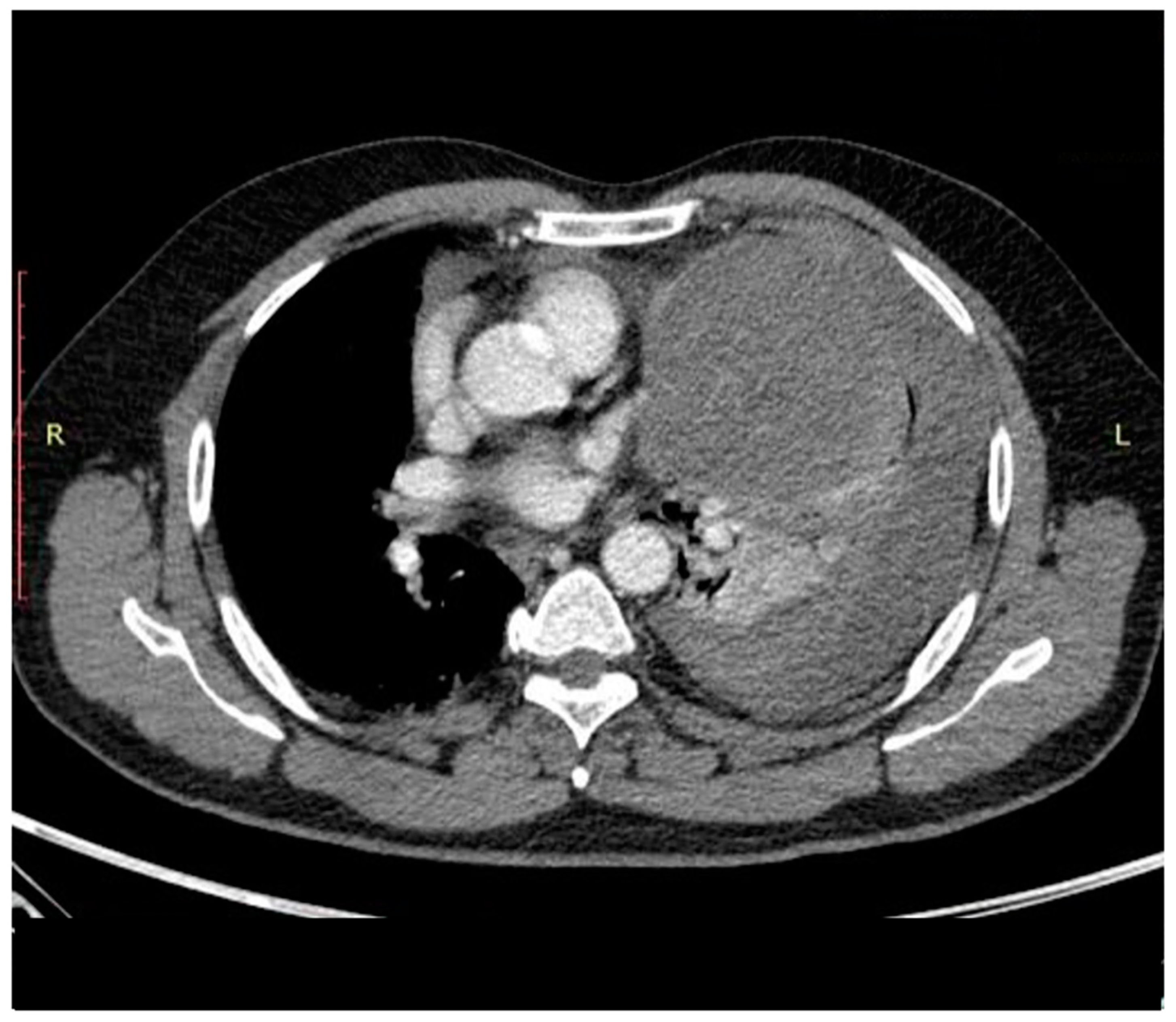 Curroncol 31 00510 g003