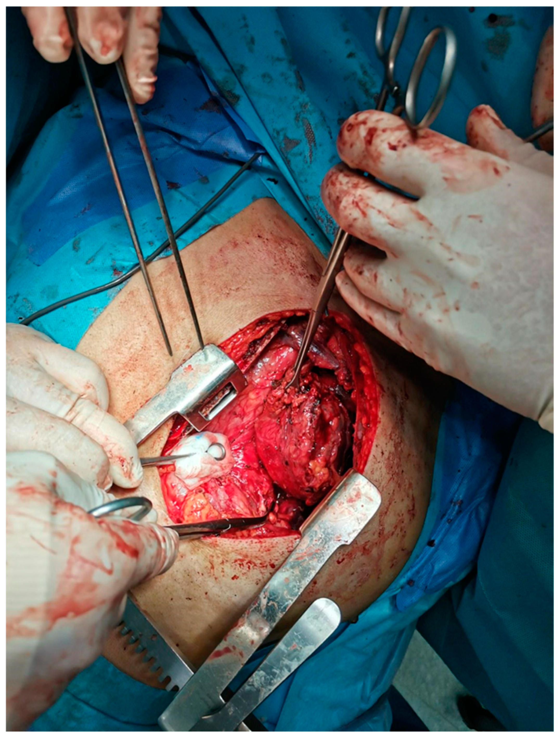 Curroncol 31 00510 g005