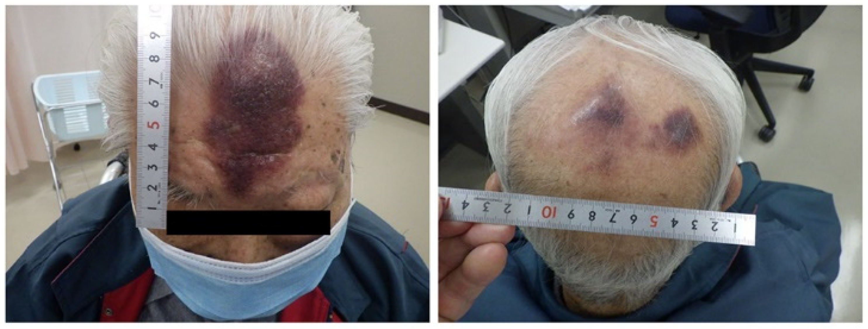 Curroncol 31 00524 g001 Curroncol 31 00524 g001