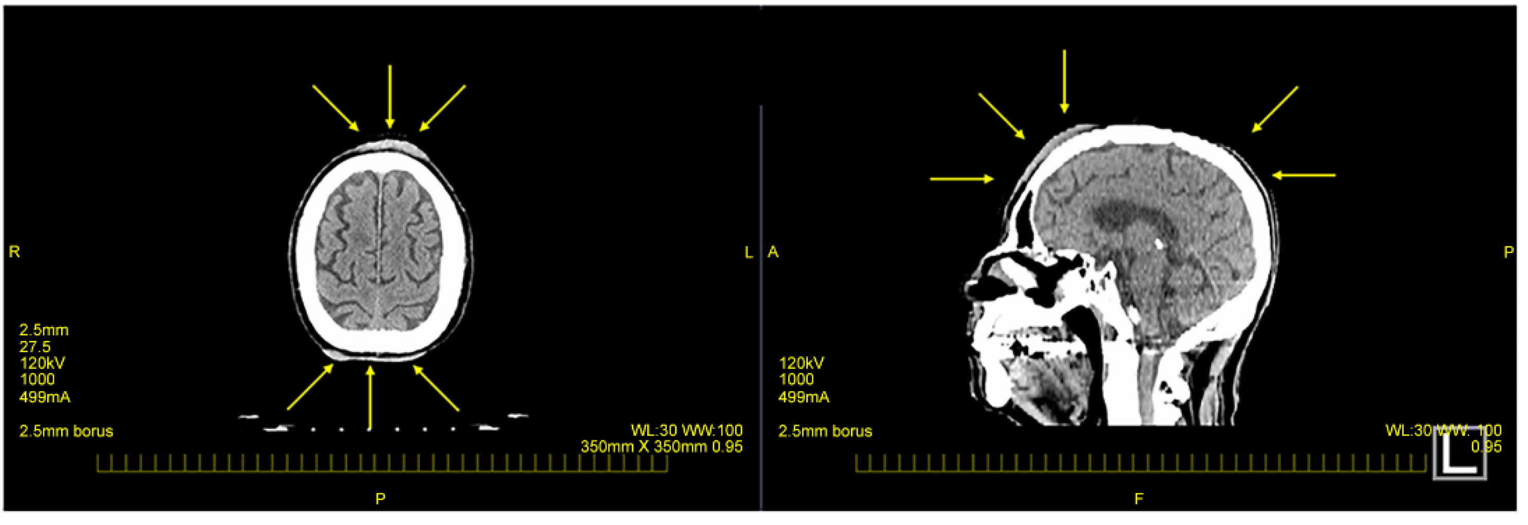 Curroncol 31 00524 g002 Curroncol 31 00524 g002