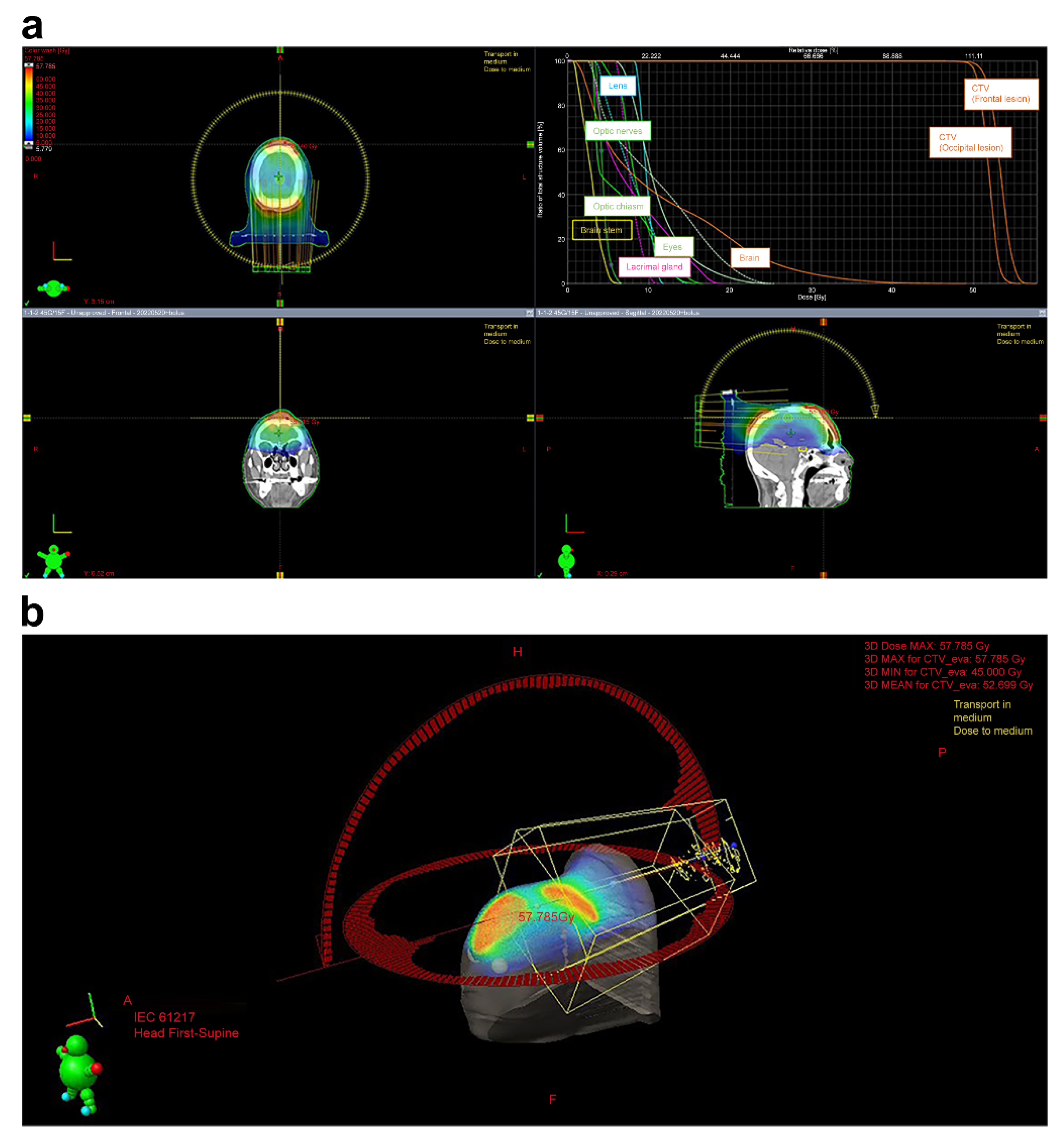 Curroncol 31 00524 g003 Curroncol 31 00524 g003
