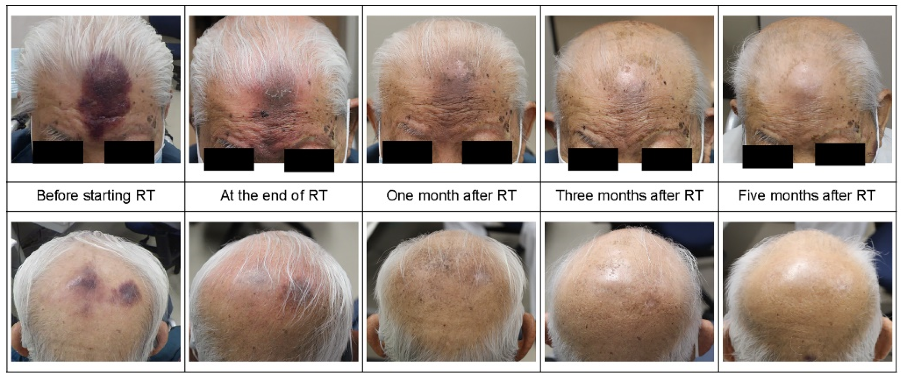 Curroncol 31 00524 g005 Curroncol 31 00524 g005