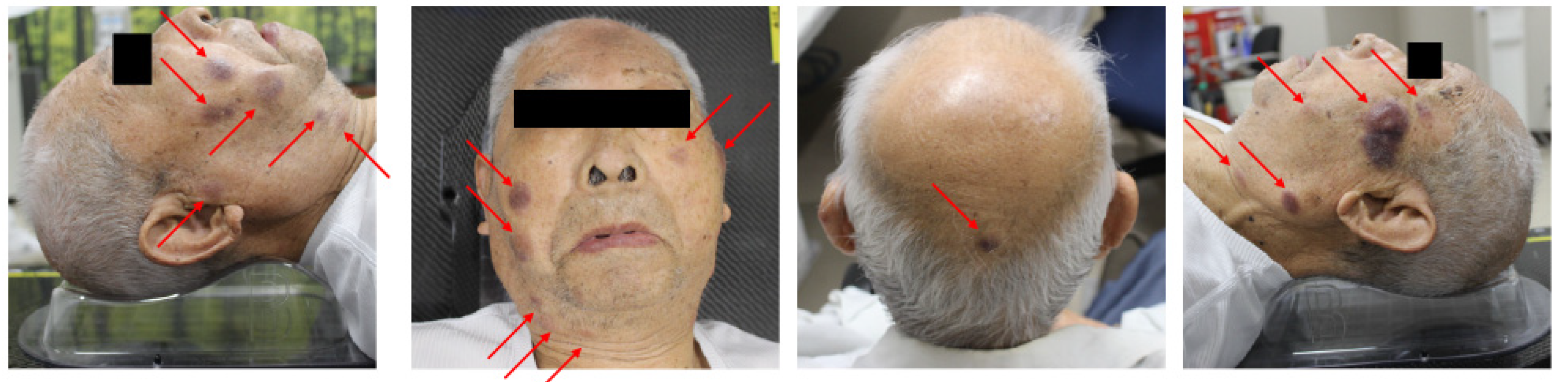 Curroncol 31 00524 g006 Curroncol 31 00524 g006