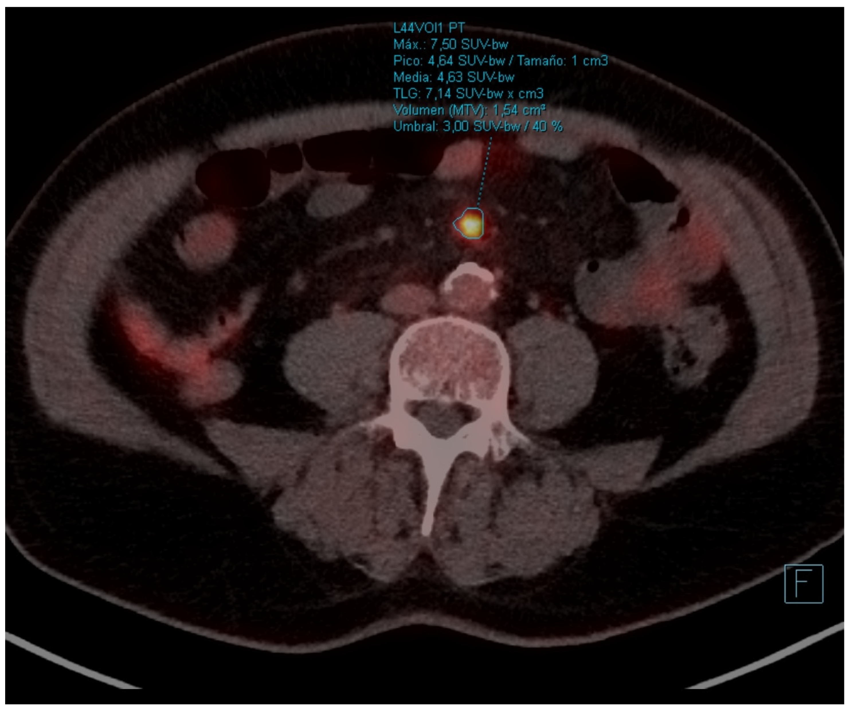 Curroncol 31 00540 g003
