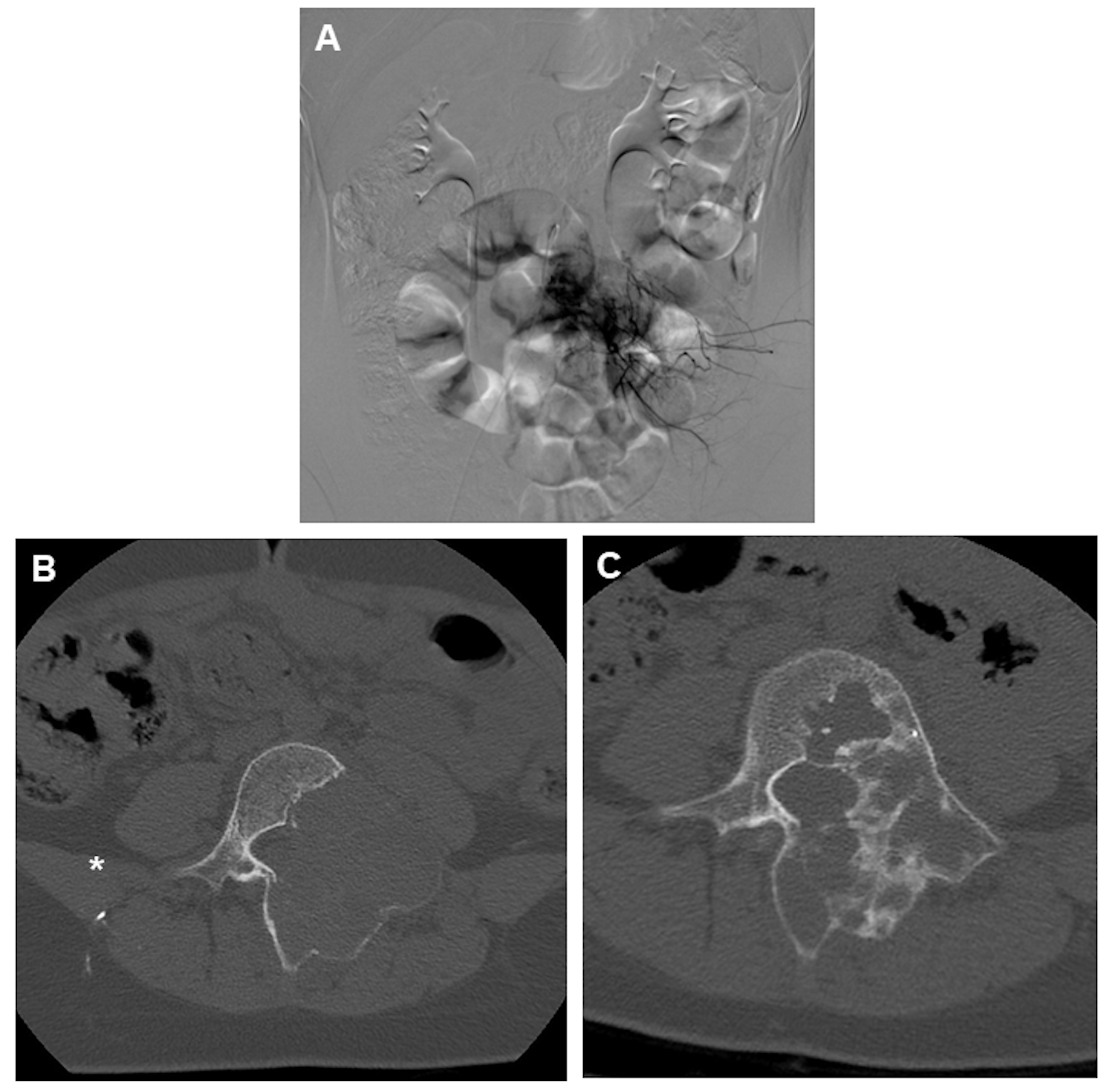 Curroncol 31 00555 g002 Curroncol 31 00555 g002