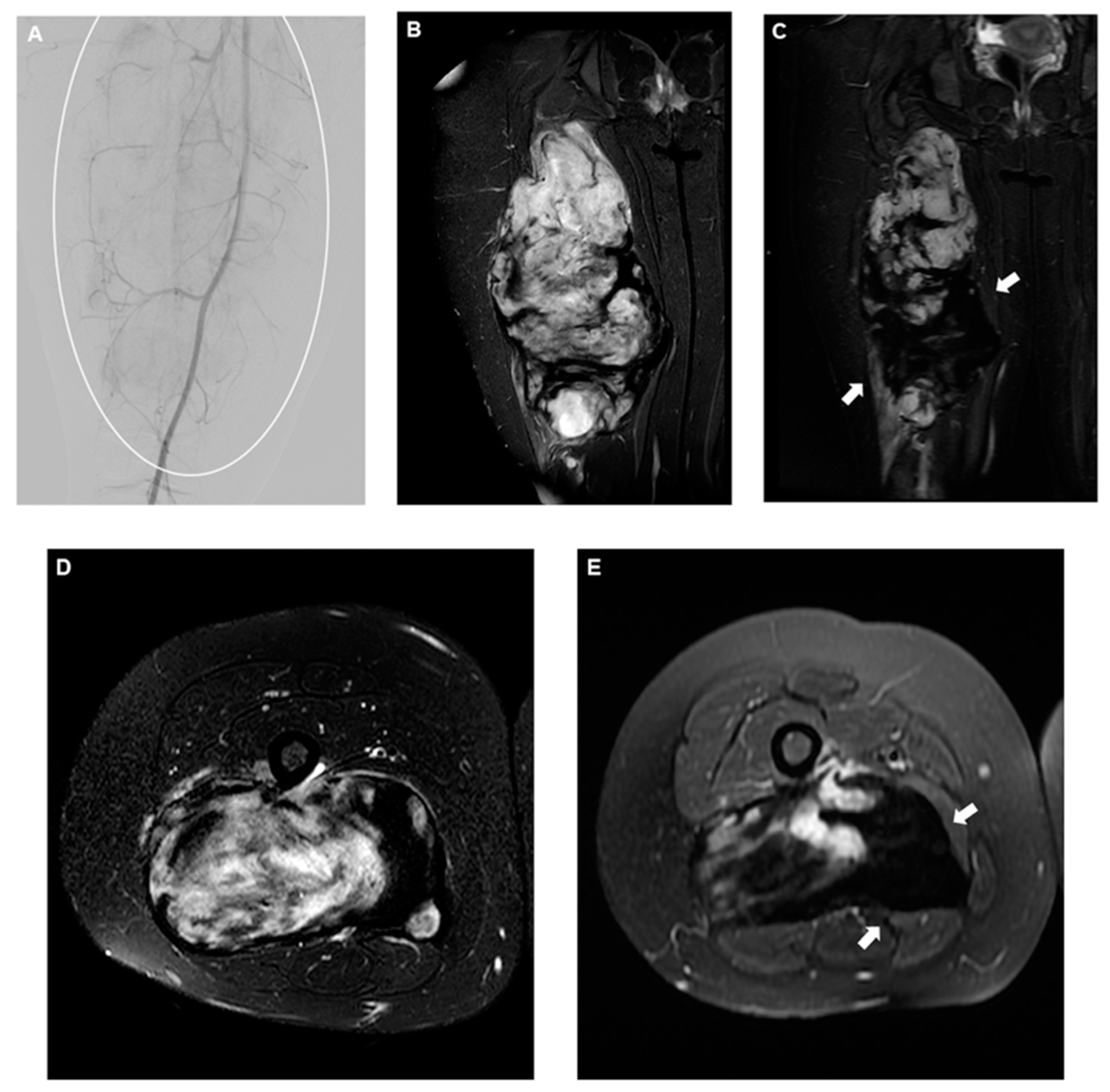 Curroncol 31 00555 g003 Curroncol 31 00555 g003