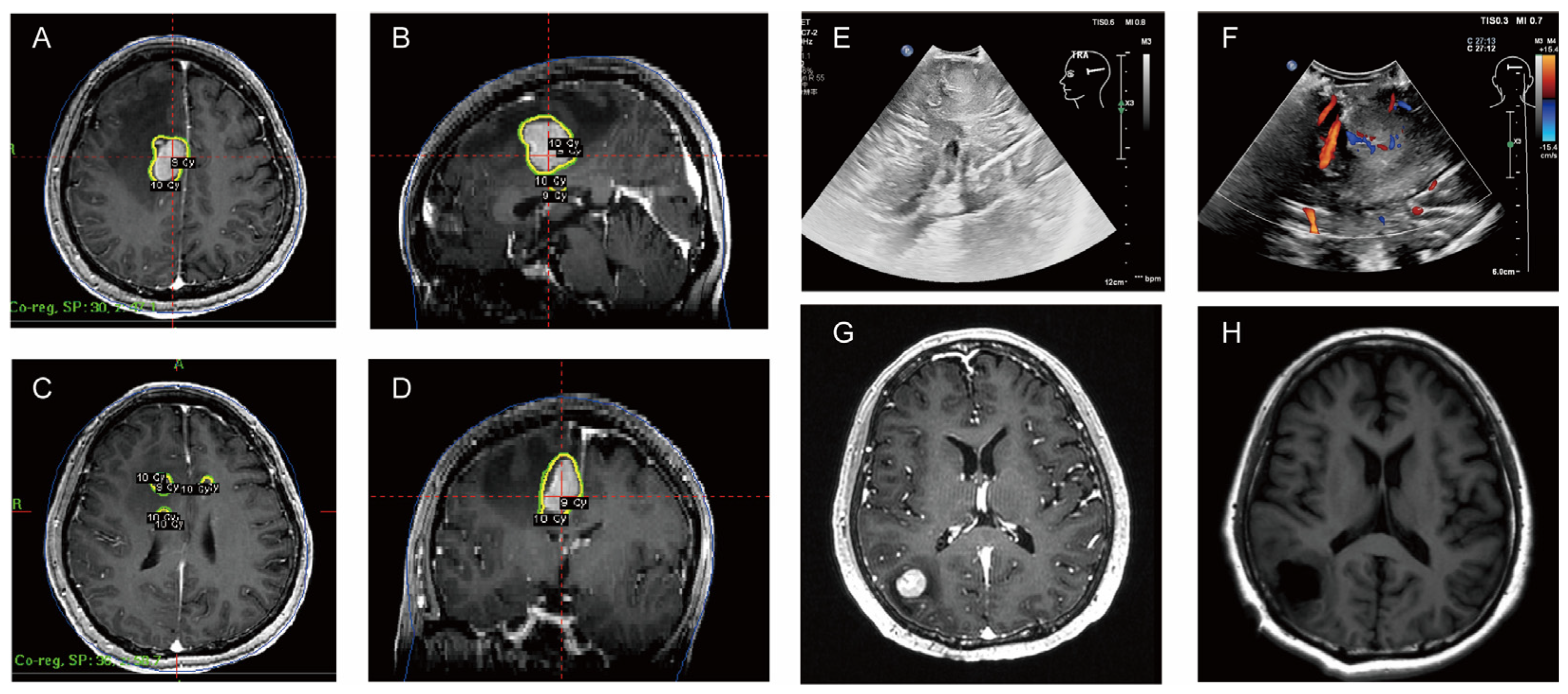 Curroncol 31 00556 g004