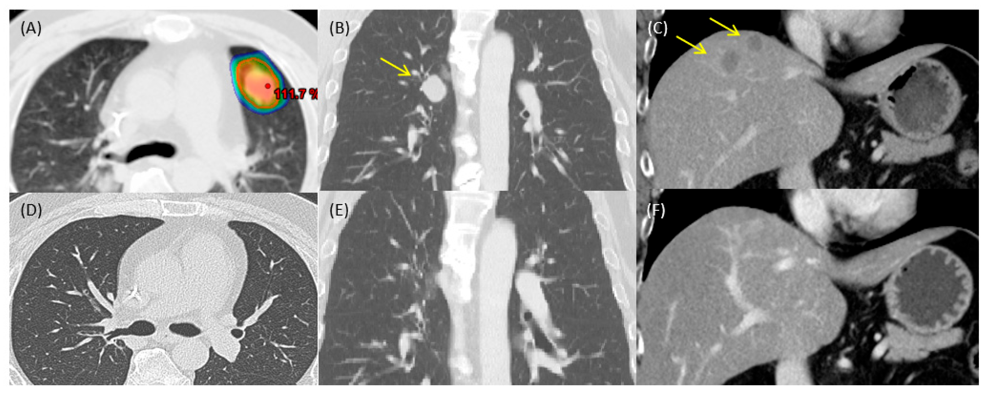 Curroncol 31 00573 g002