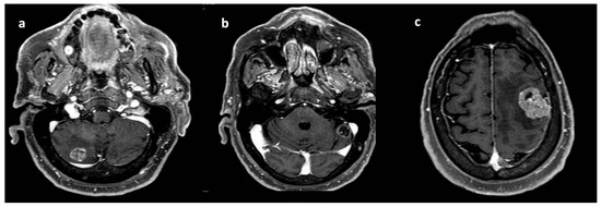 内科診断学 = MEDICAL DIAGNOSIS 61m3-QqLjQL.jpg