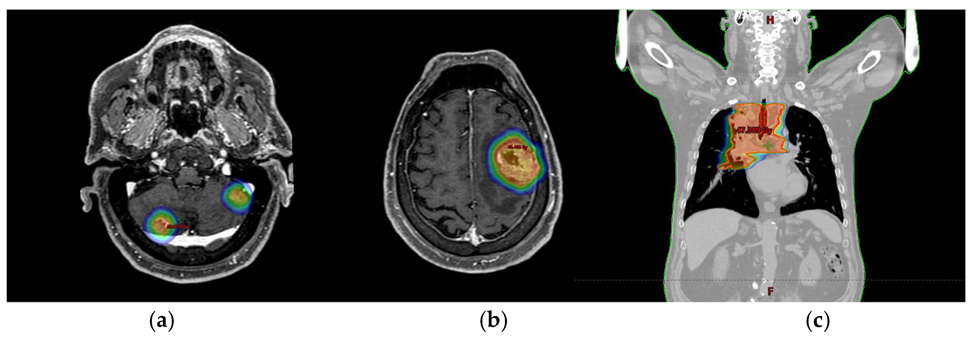 Curroncol 31 00598 g003