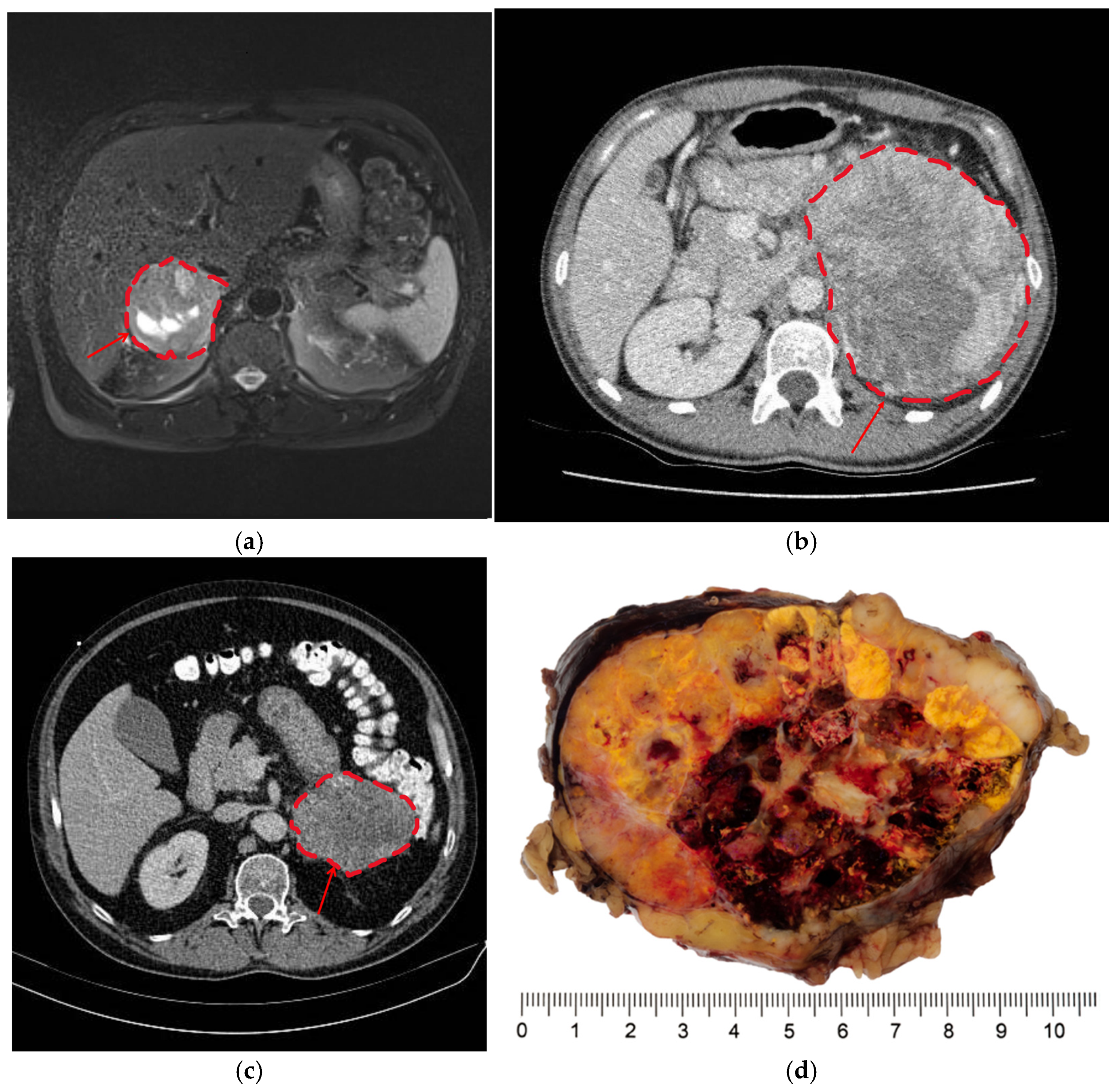 Curroncol 32 00025 g001
