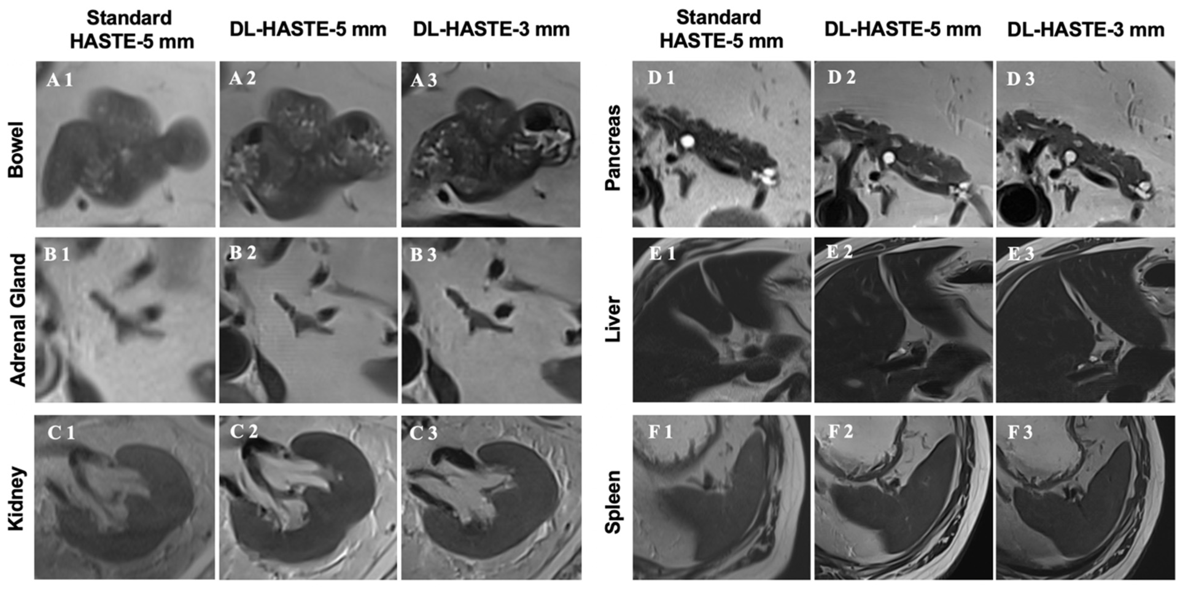 Curroncol 32 00030 g004