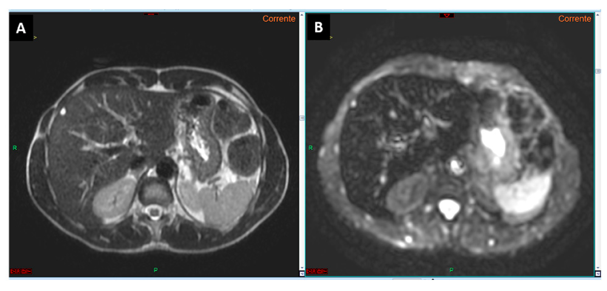 Curroncol 32 00040 g002