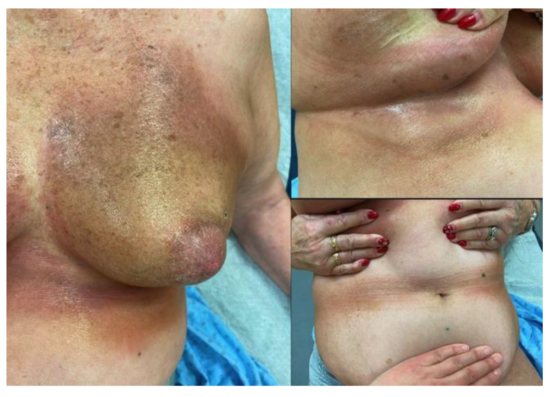 Curroncol 32 00050 g001 Curroncol 32 00050 g001