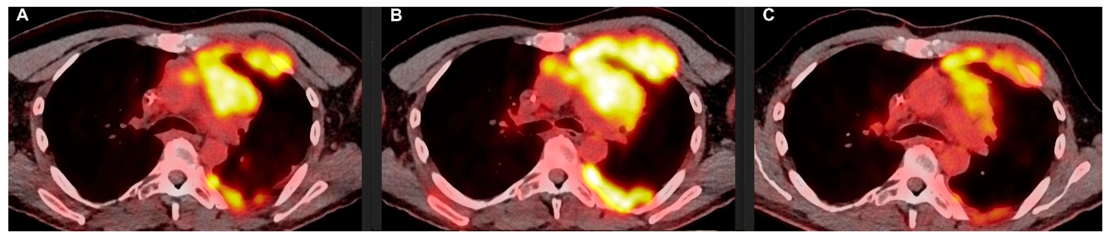 Curroncol 32 00068 g002