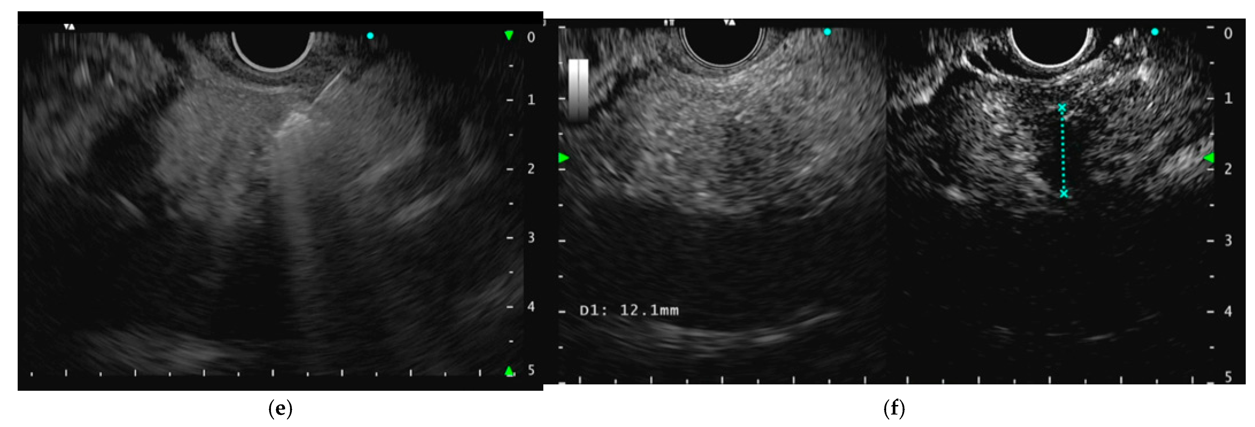 Curroncol 32 00113 g001b