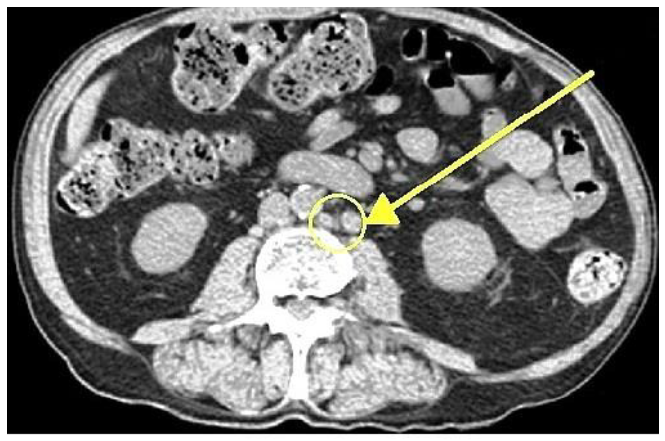 Curroncol 32 00115 g001