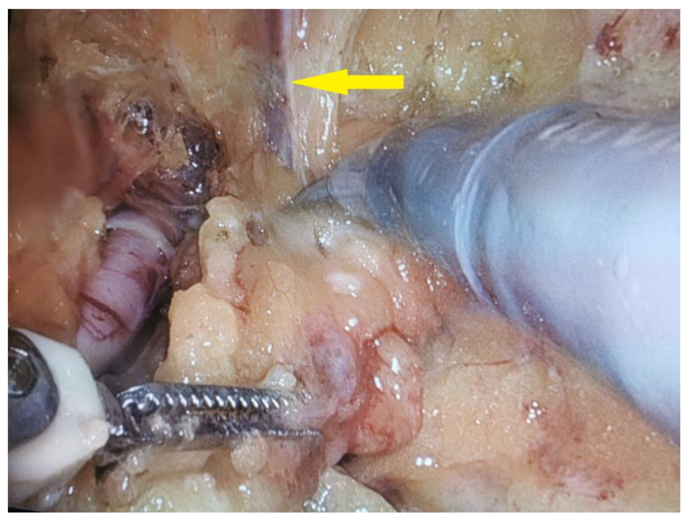 Curroncol 32 00115 g003