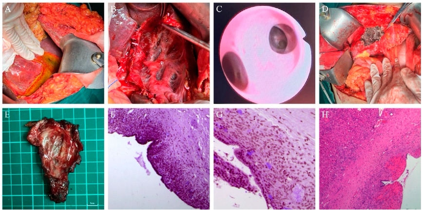 Curroncol 32 00126 g002