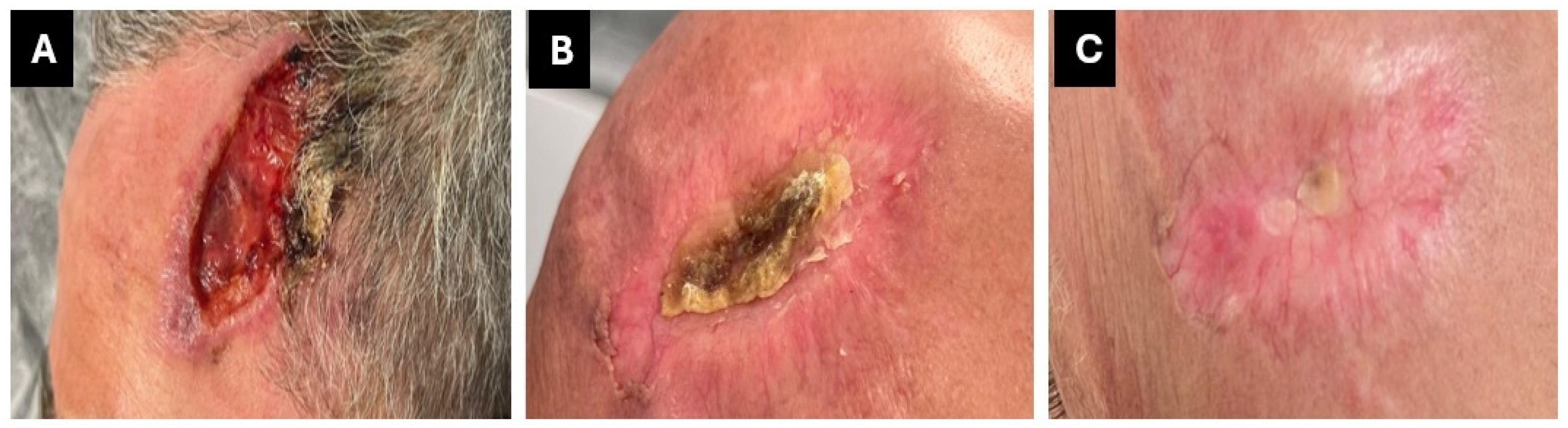 Curroncol 32 00164 g003