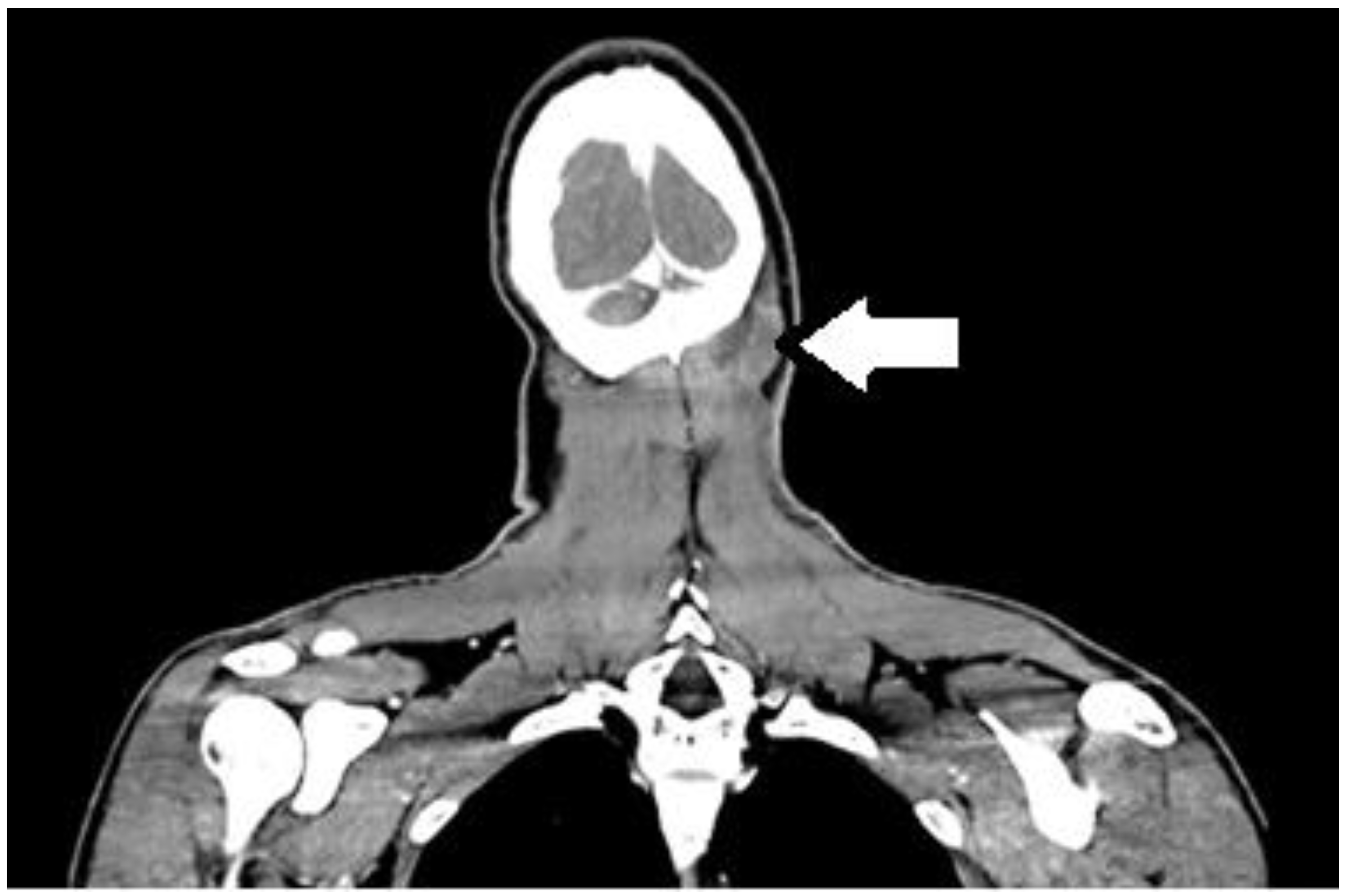 Curroncol 32 00193 g002 Curroncol 32 00193 g002