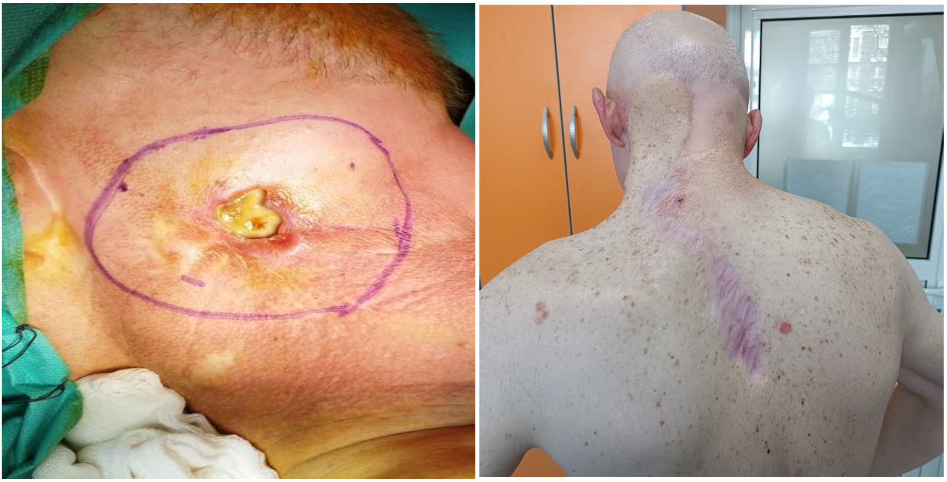 Curroncol 32 00193 g003 Curroncol 32 00193 g003