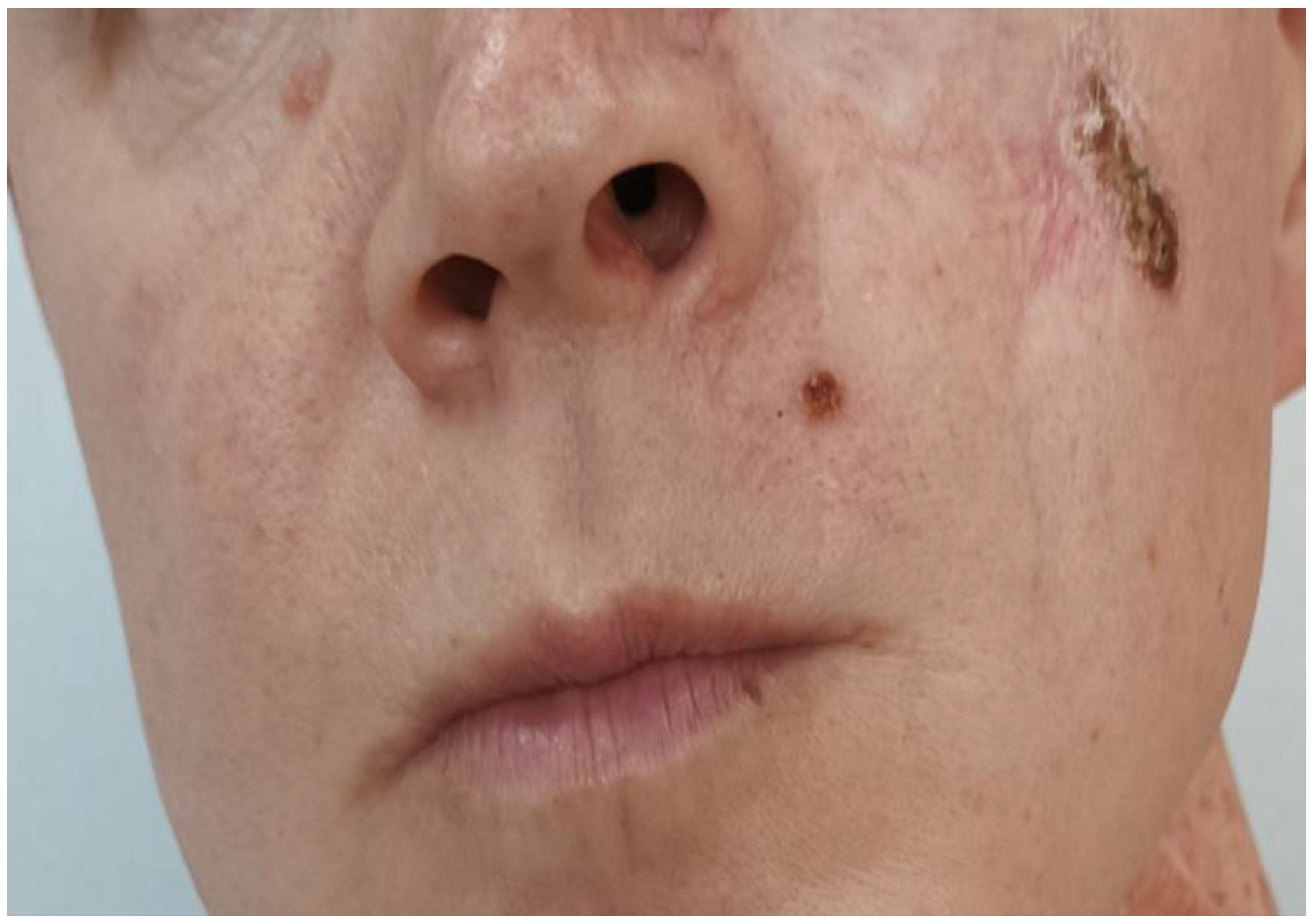 Curroncol 32 00193 g004 Curroncol 32 00193 g004