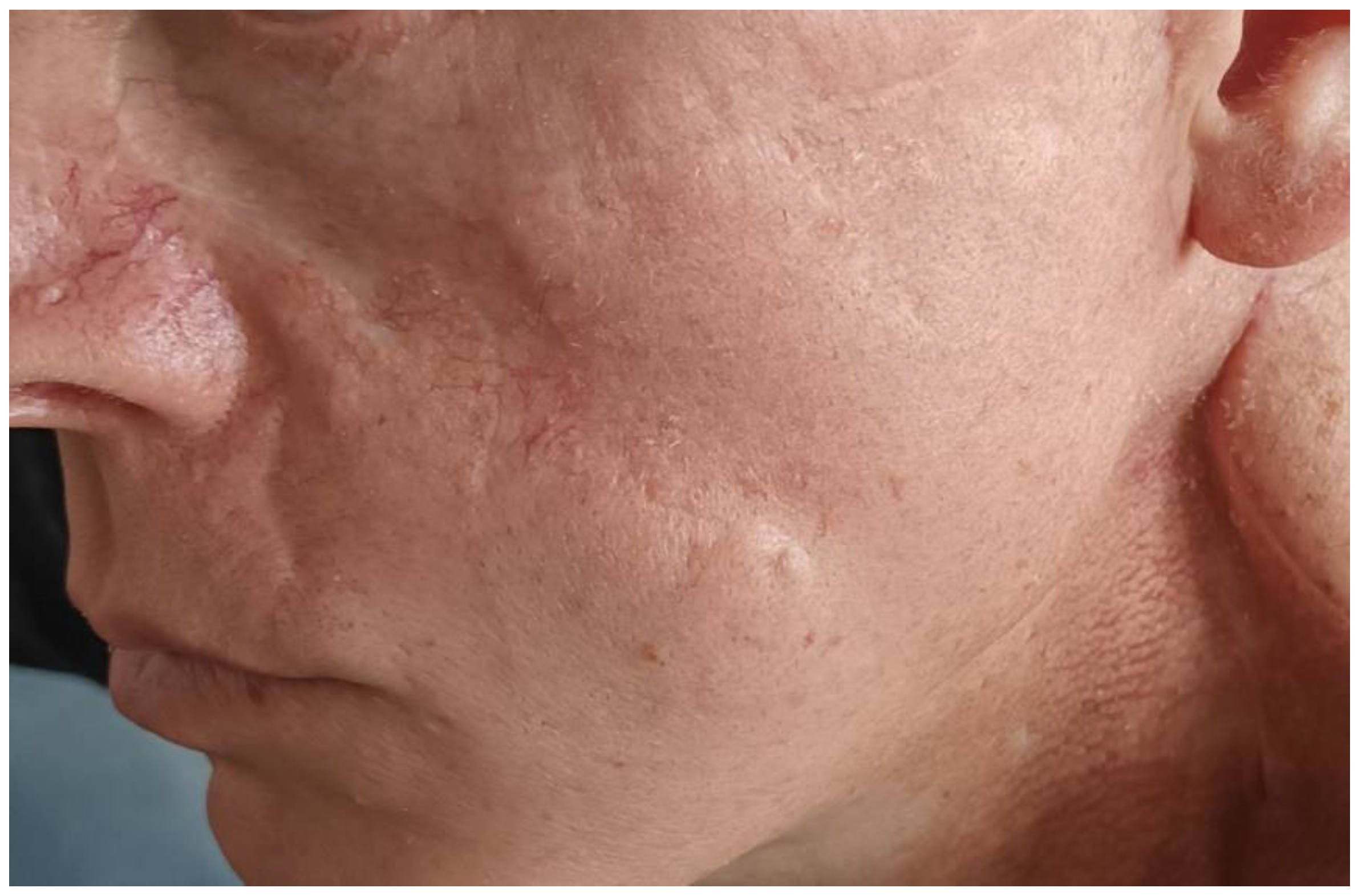 Curroncol 32 00193 g005 Curroncol 32 00193 g005