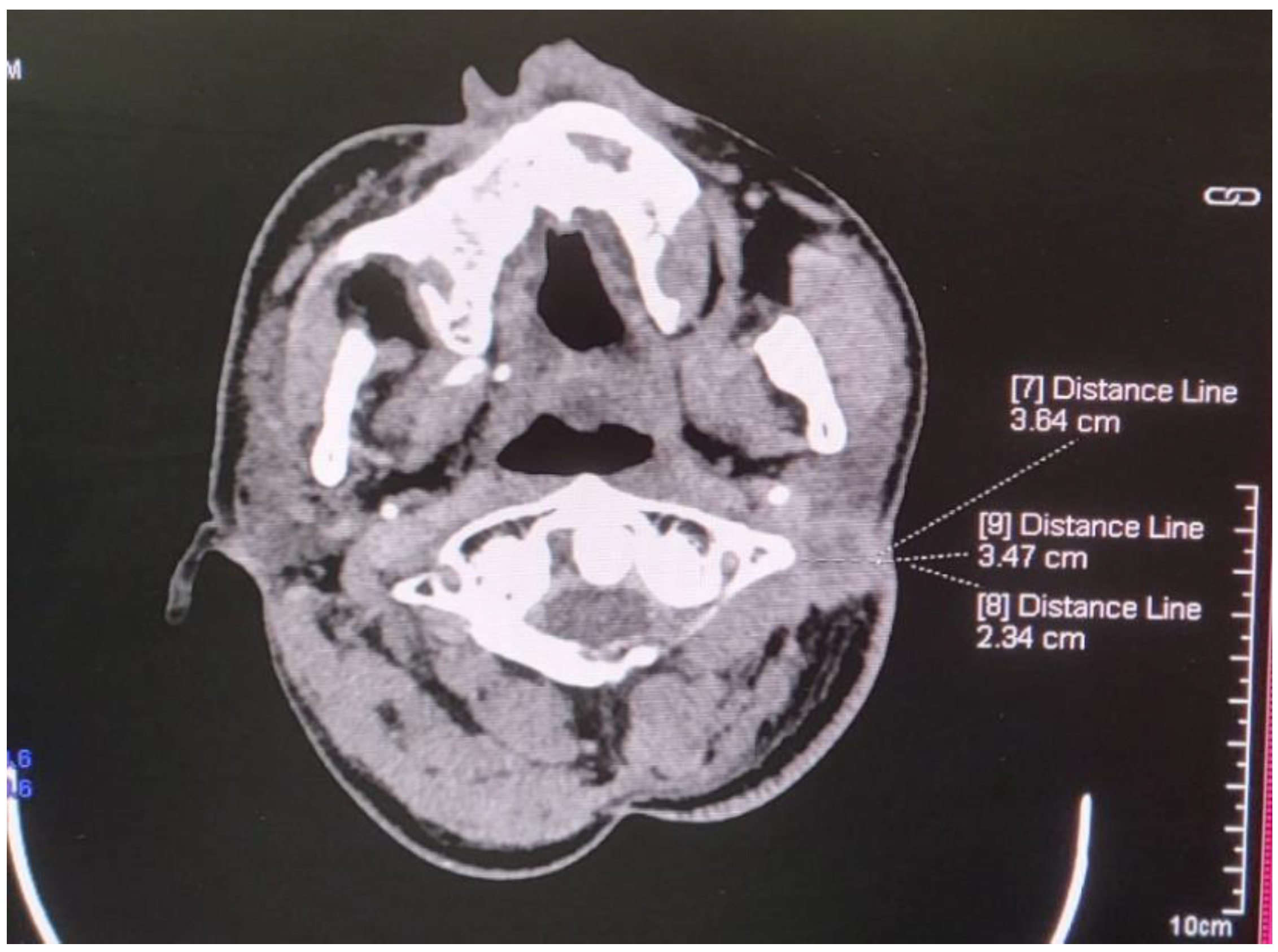 Curroncol 32 00193 g006 Curroncol 32 00193 g006