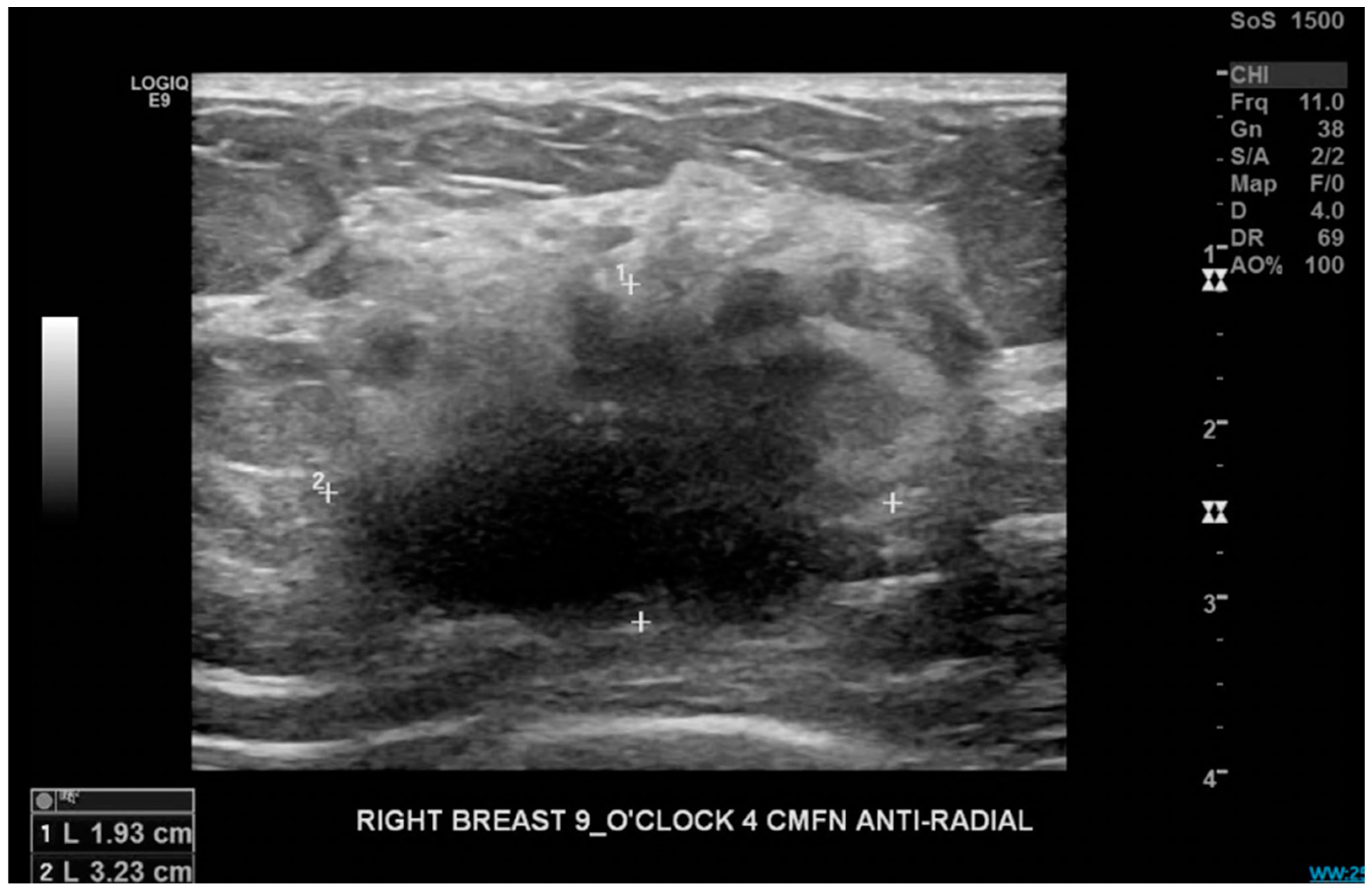 Curroncol 32 00205 sch003 Curroncol 32 00205 sch003