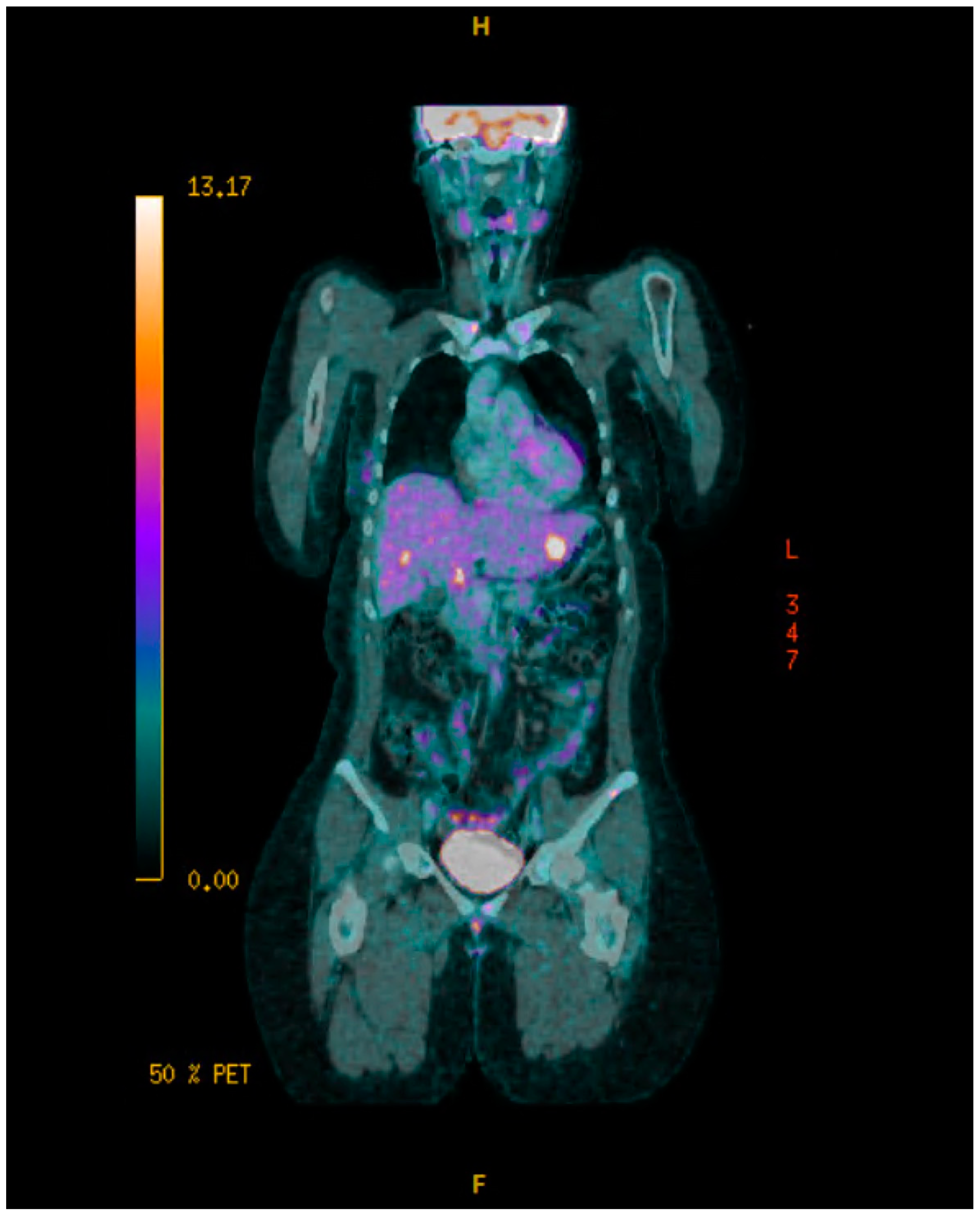 Curroncol 32 00205 sch004 Curroncol 32 00205 sch004