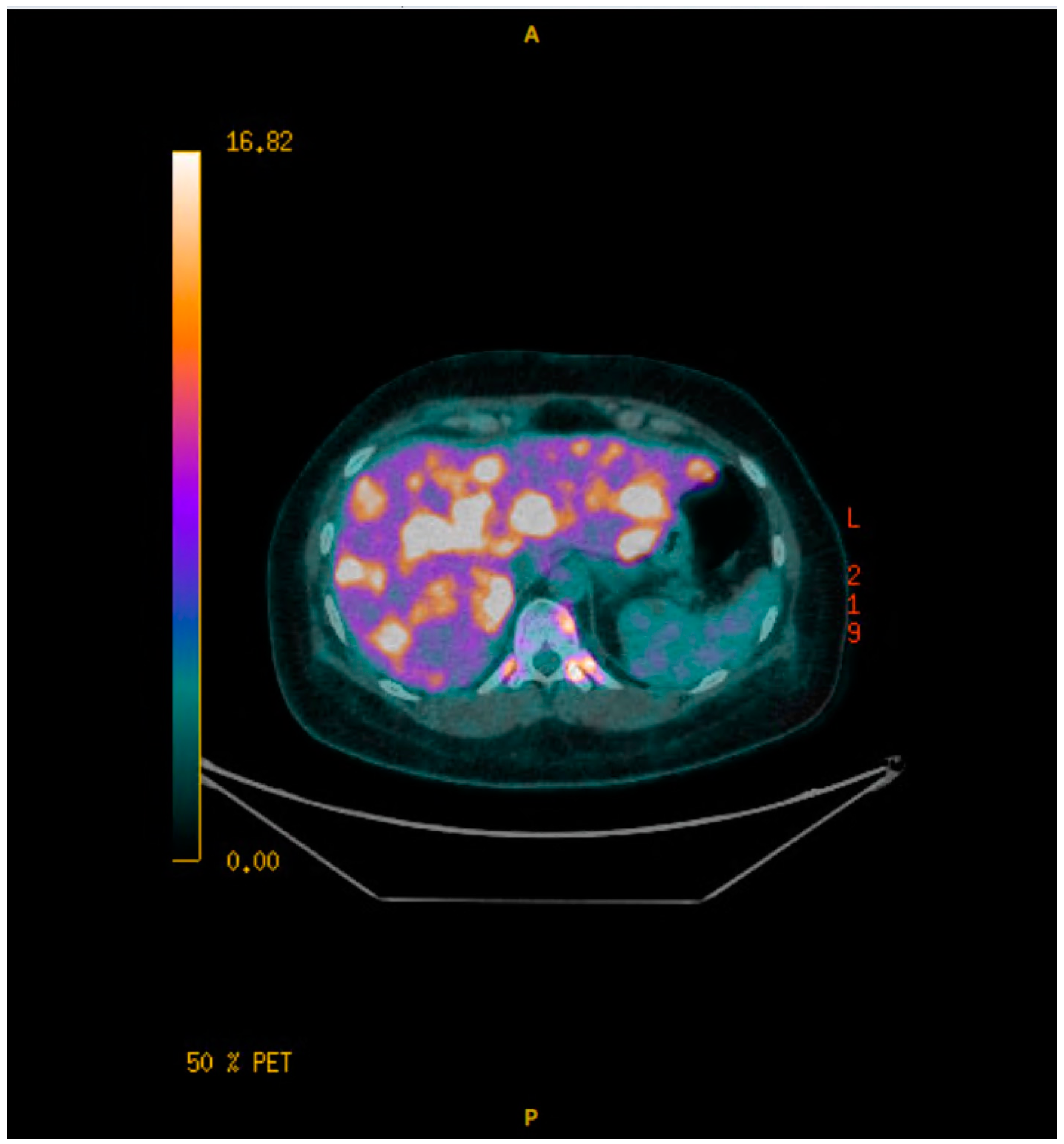 Curroncol 32 00205 sch005 Curroncol 32 00205 sch005