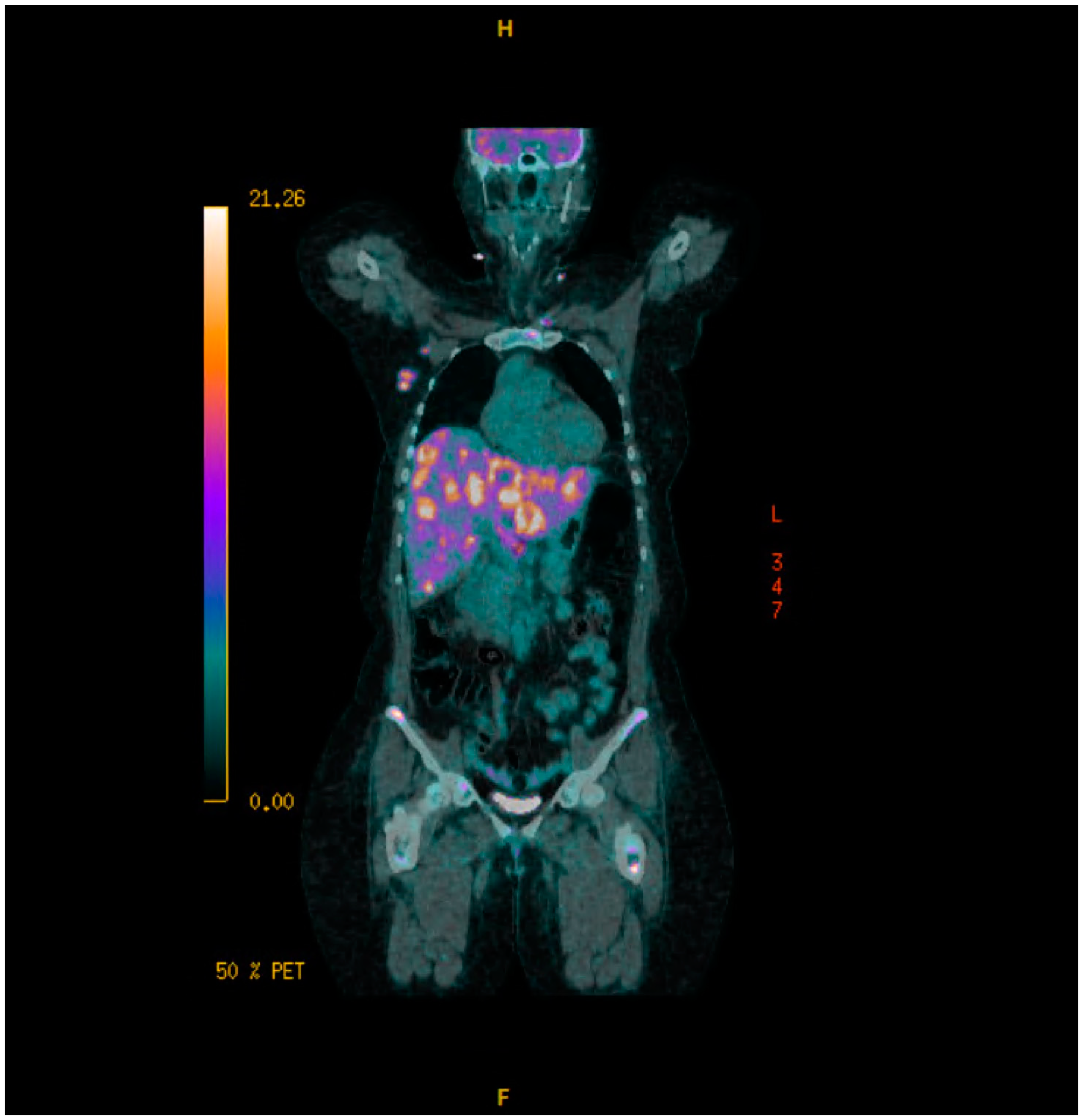 Curroncol 32 00205 sch006 Curroncol 32 00205 sch006