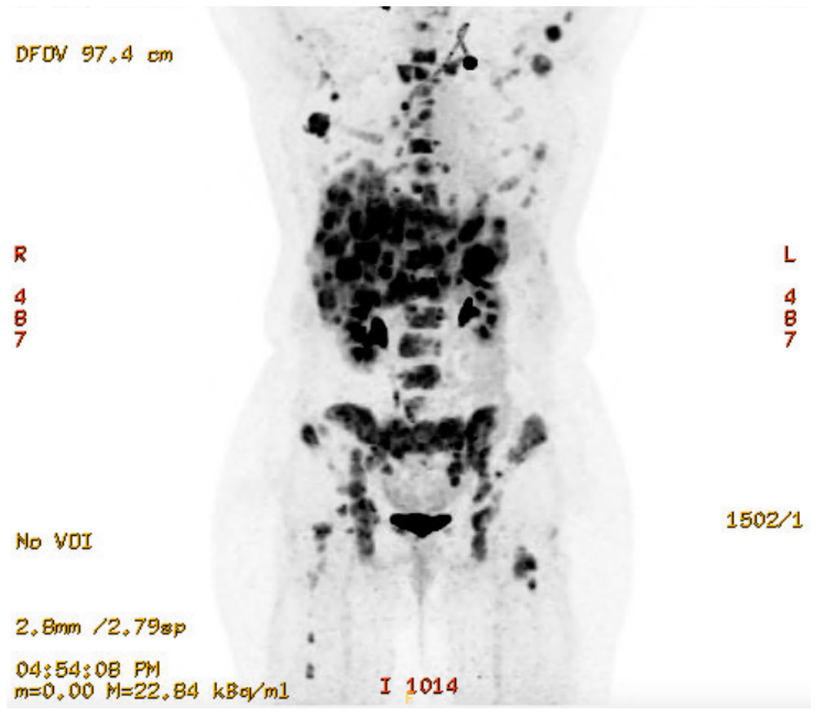 Curroncol 32 00205 sch007 Curroncol 32 00205 sch007