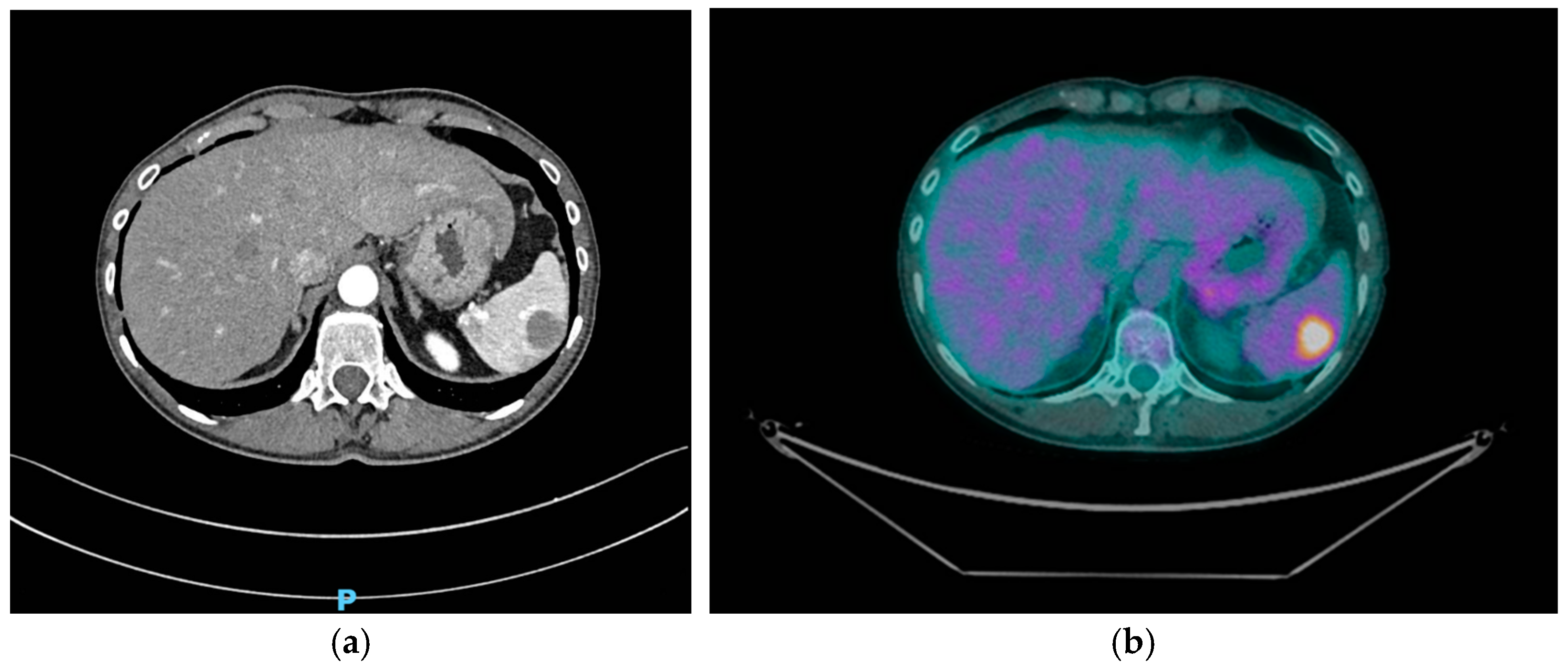Curroncol 32 00218 g001