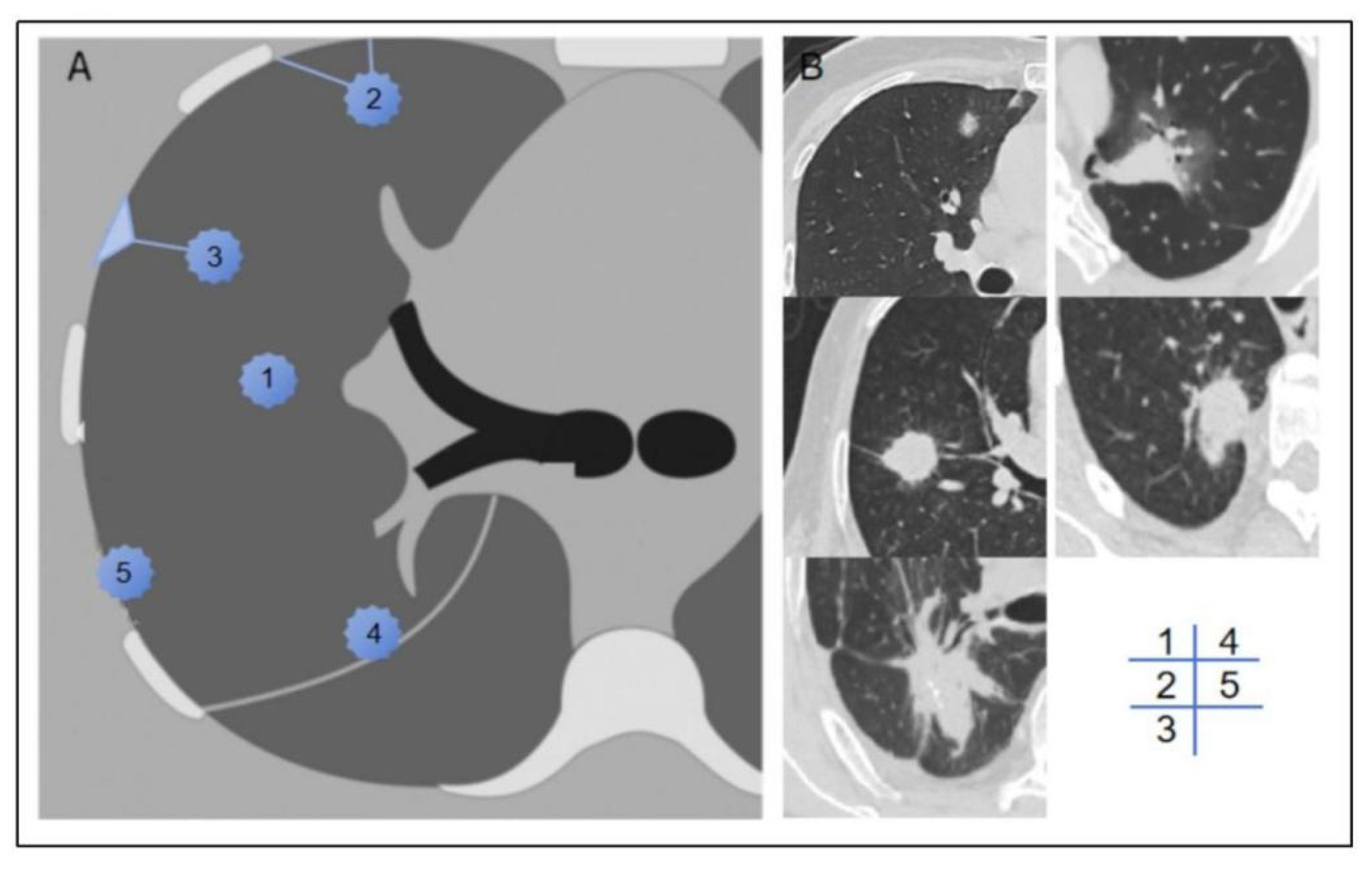 Curroncol 32 00223 g002 Curroncol 32 00223 g002
