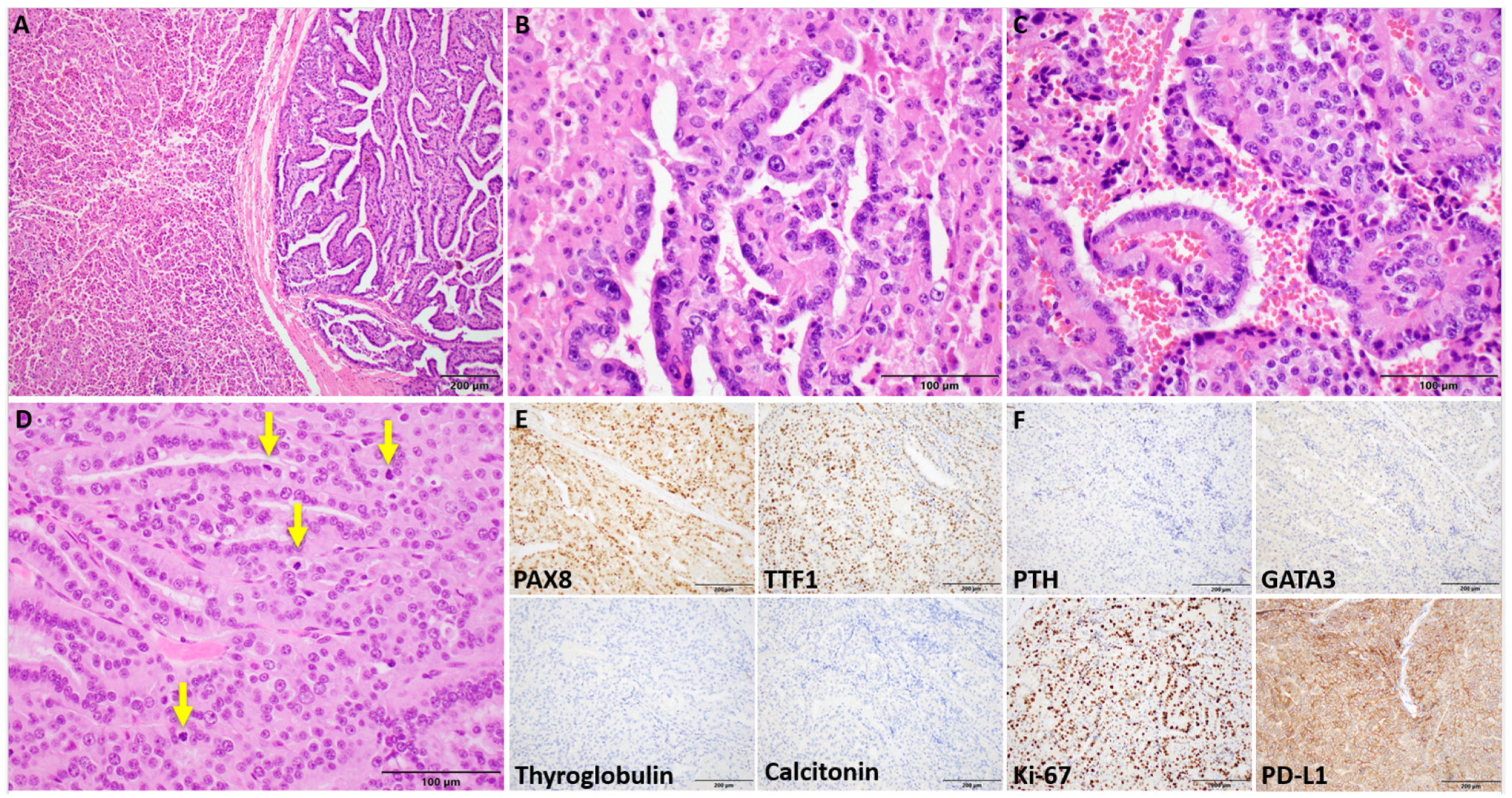 Curroncol 32 00224 g002 Curroncol 32 00224 g002