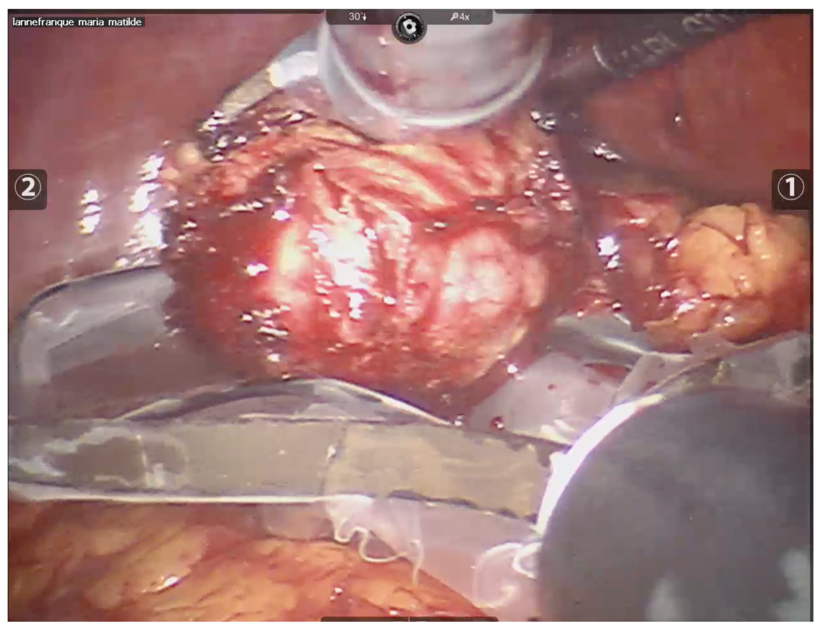 Curroncol 32 00246 g004