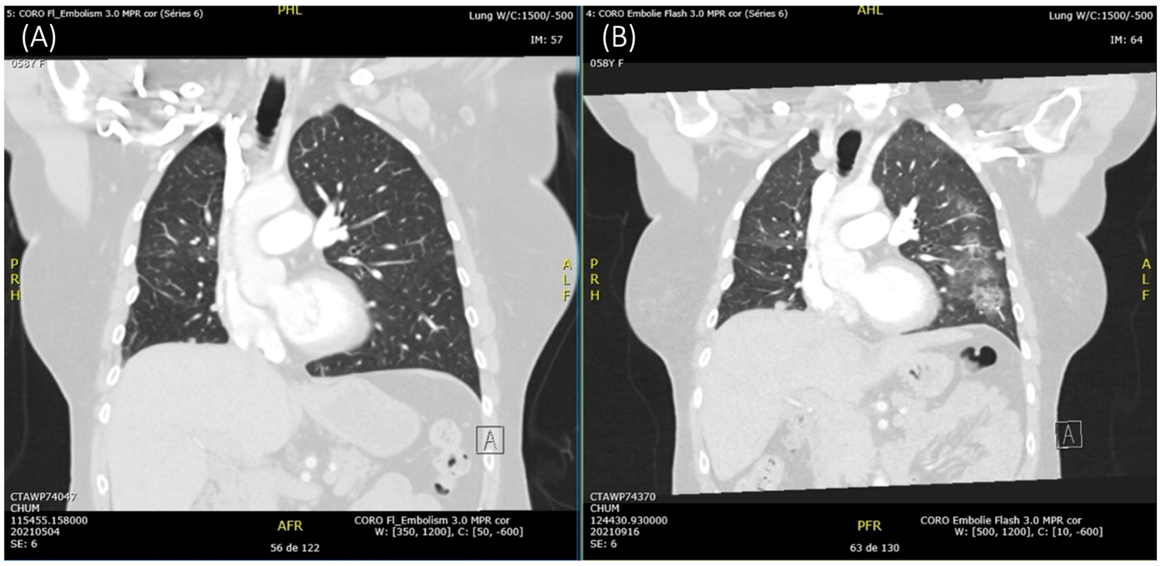 Curroncol 32 00270 g002