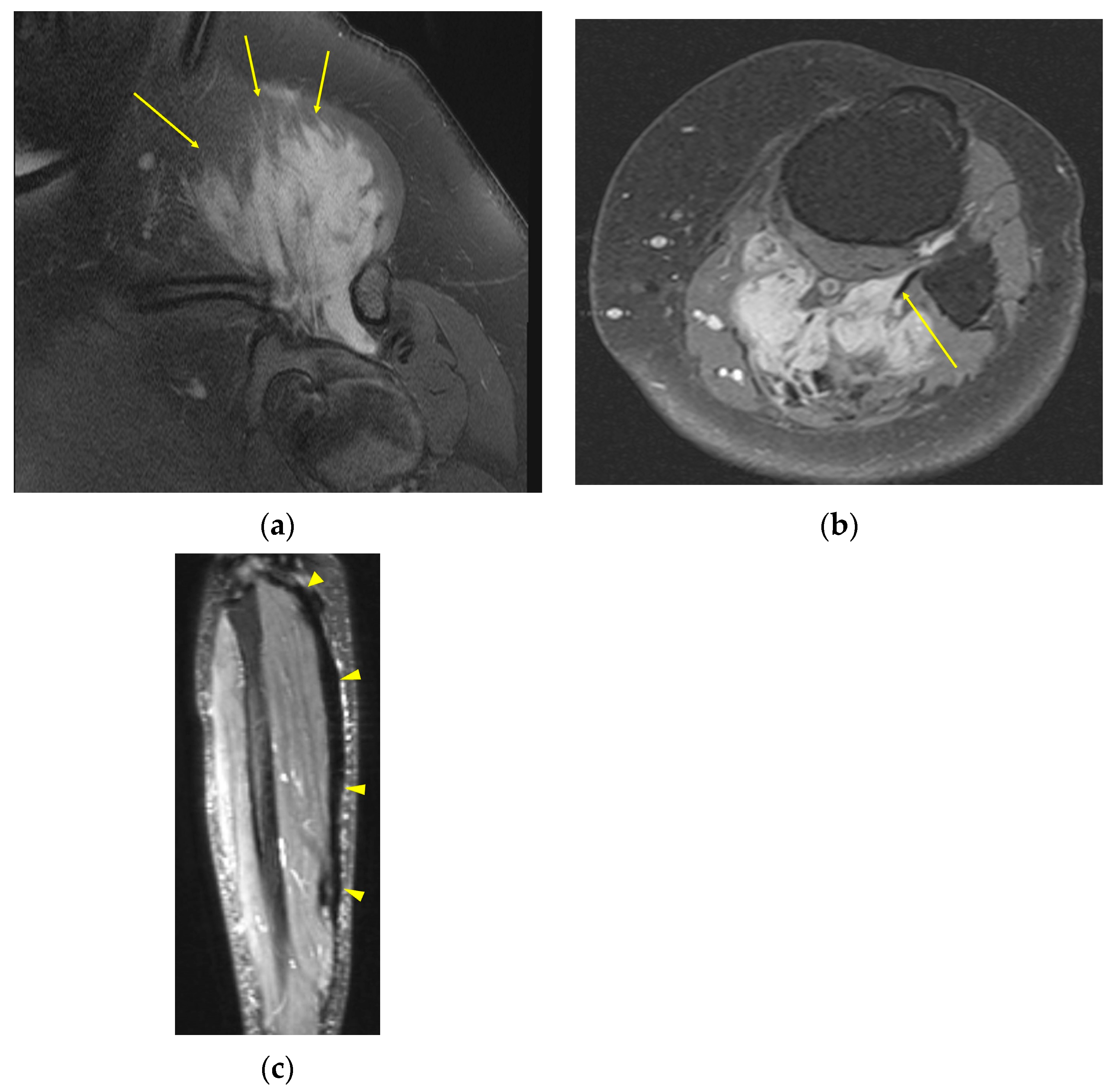 Curroncol 32 00288 g001