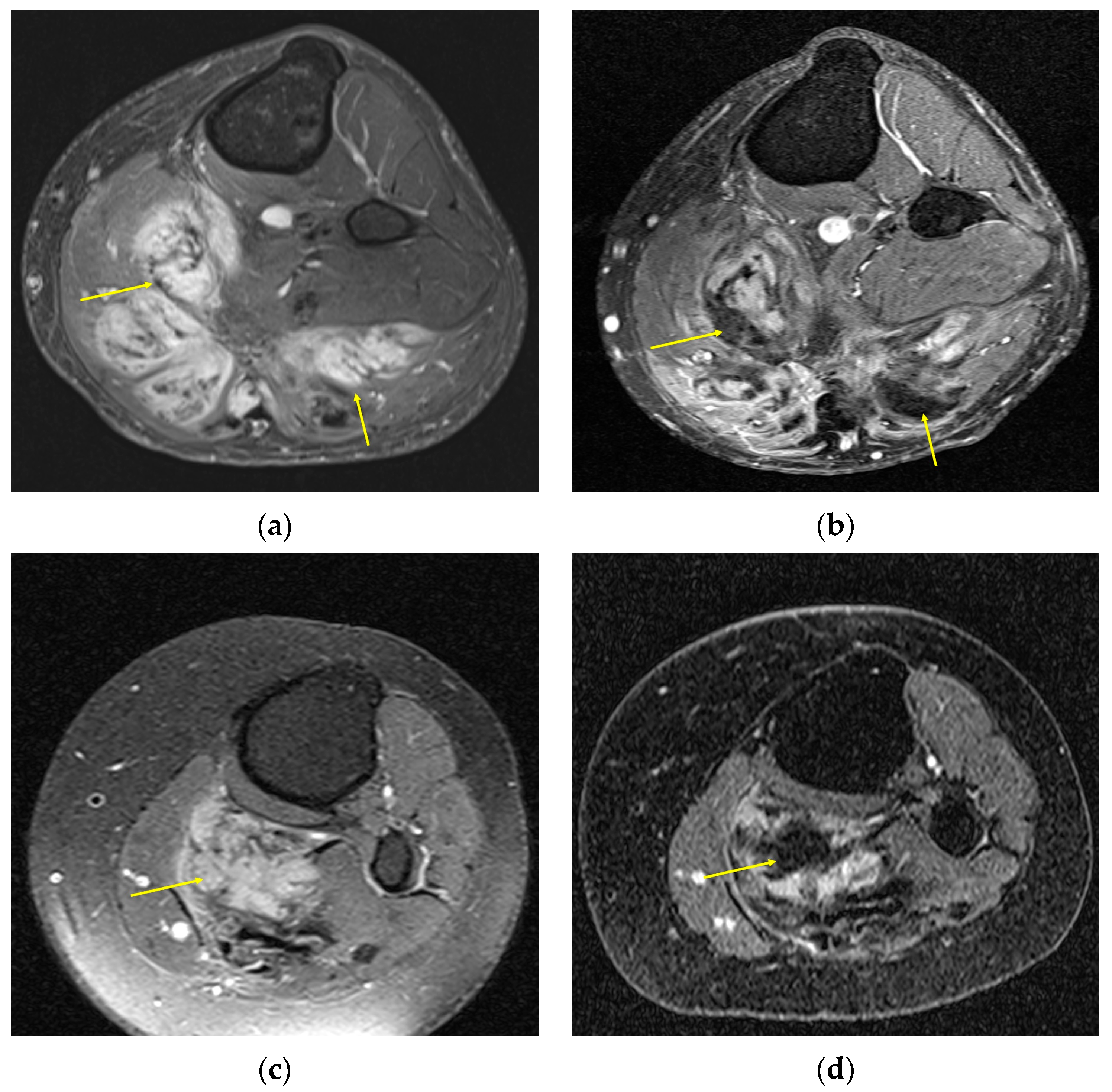 Curroncol 32 00288 g002