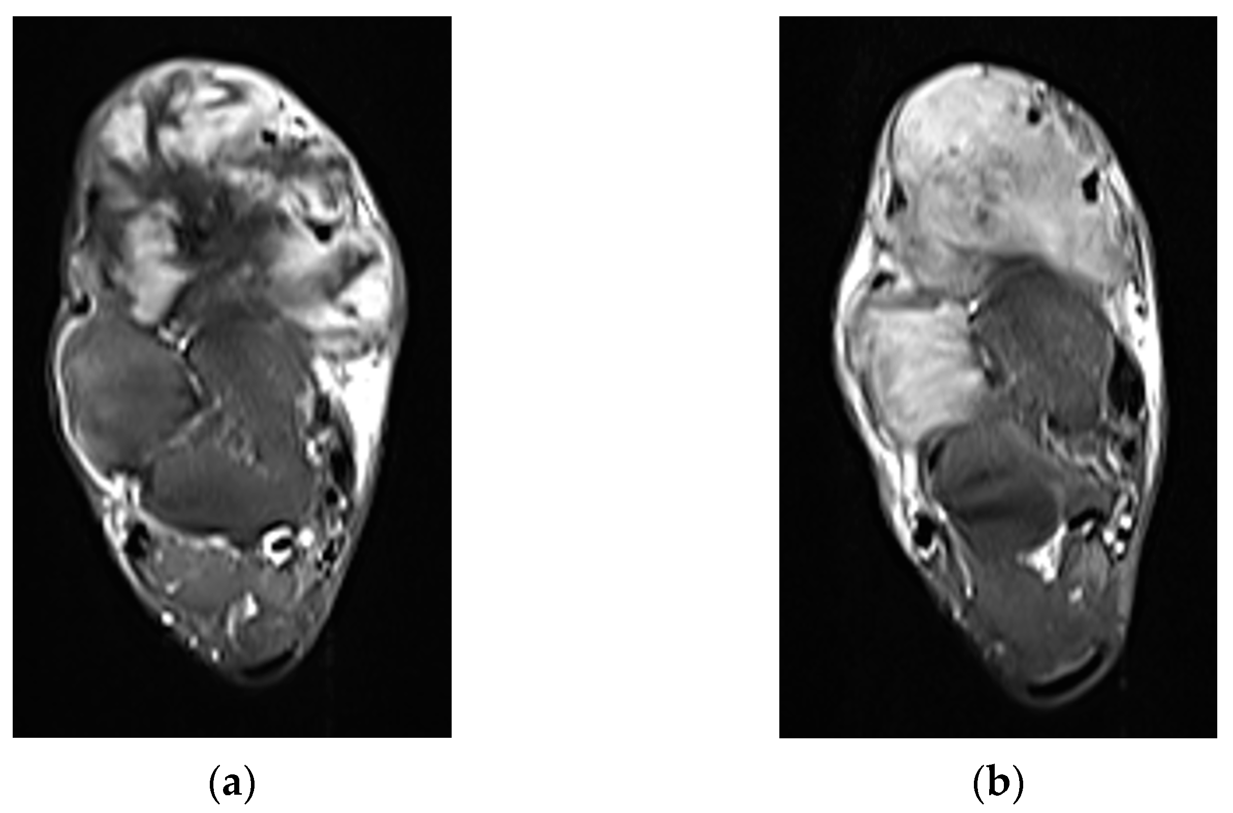 Curroncol 32 00288 g003a