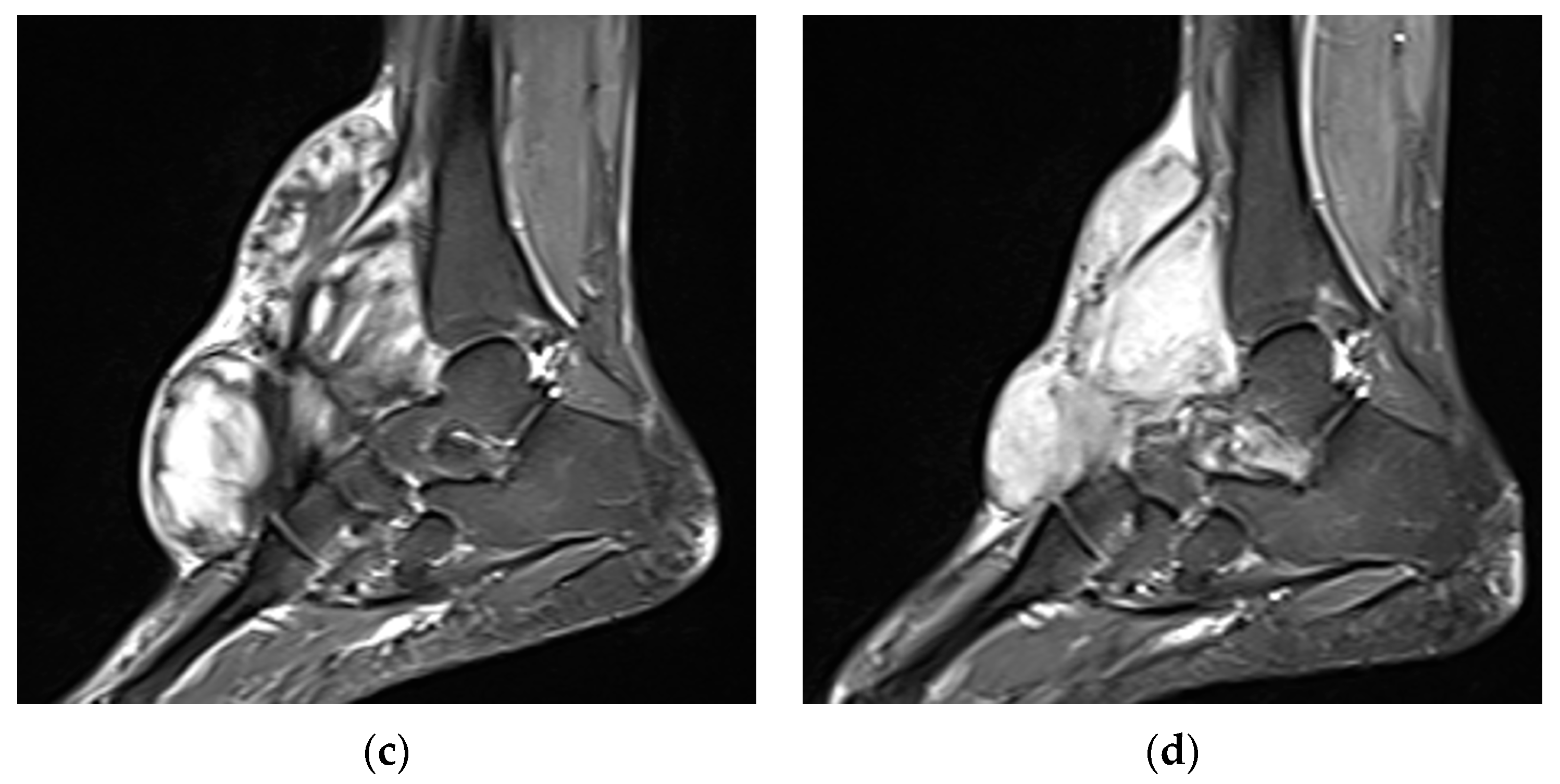 Curroncol 32 00288 g003b