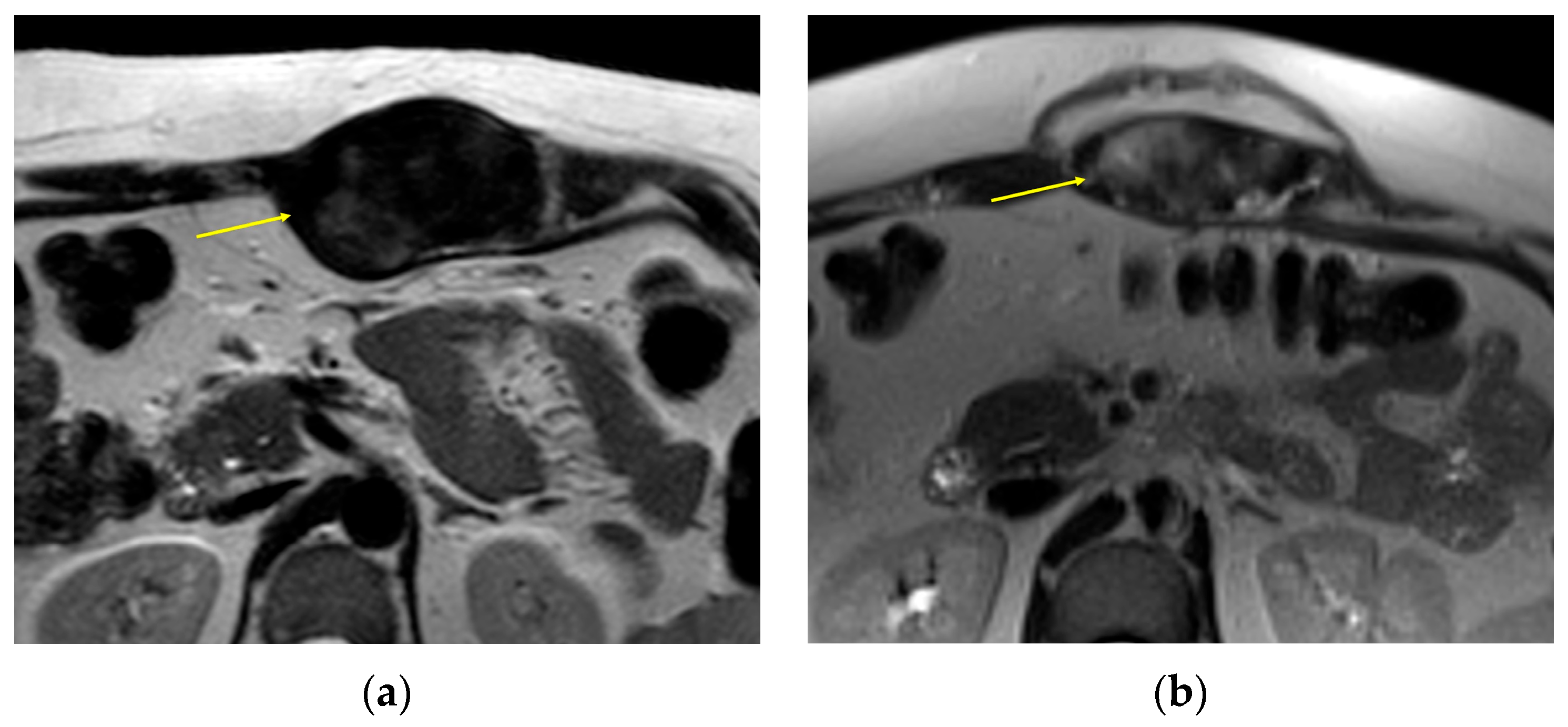 Curroncol 32 00288 g004a