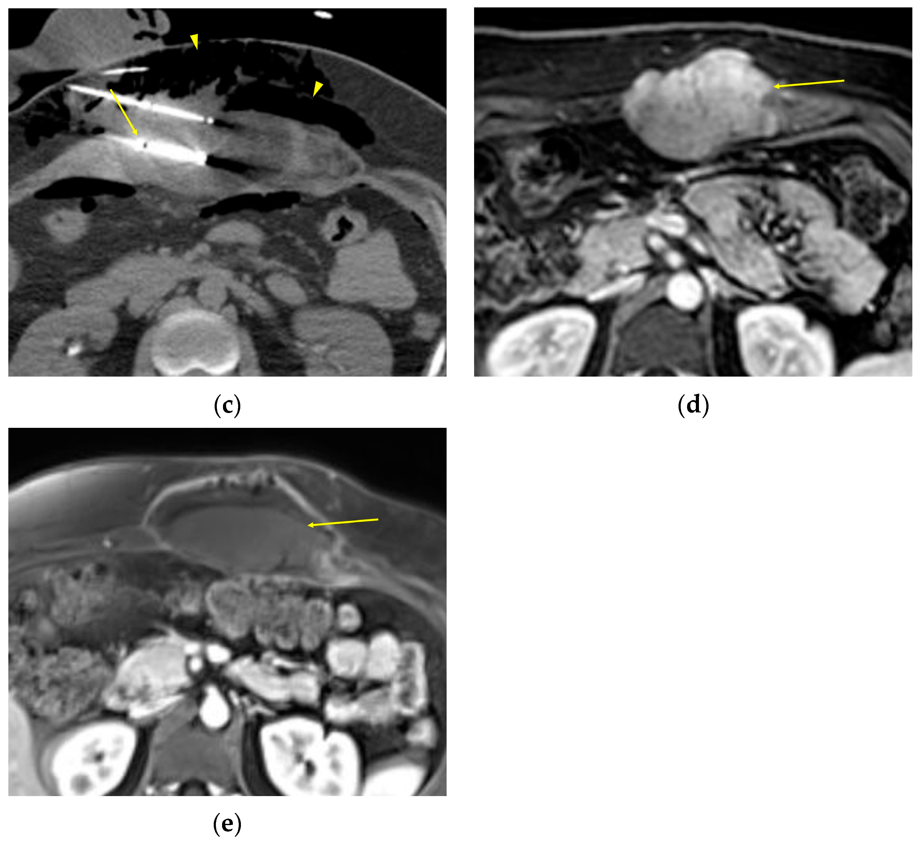 Curroncol 32 00288 g004b
