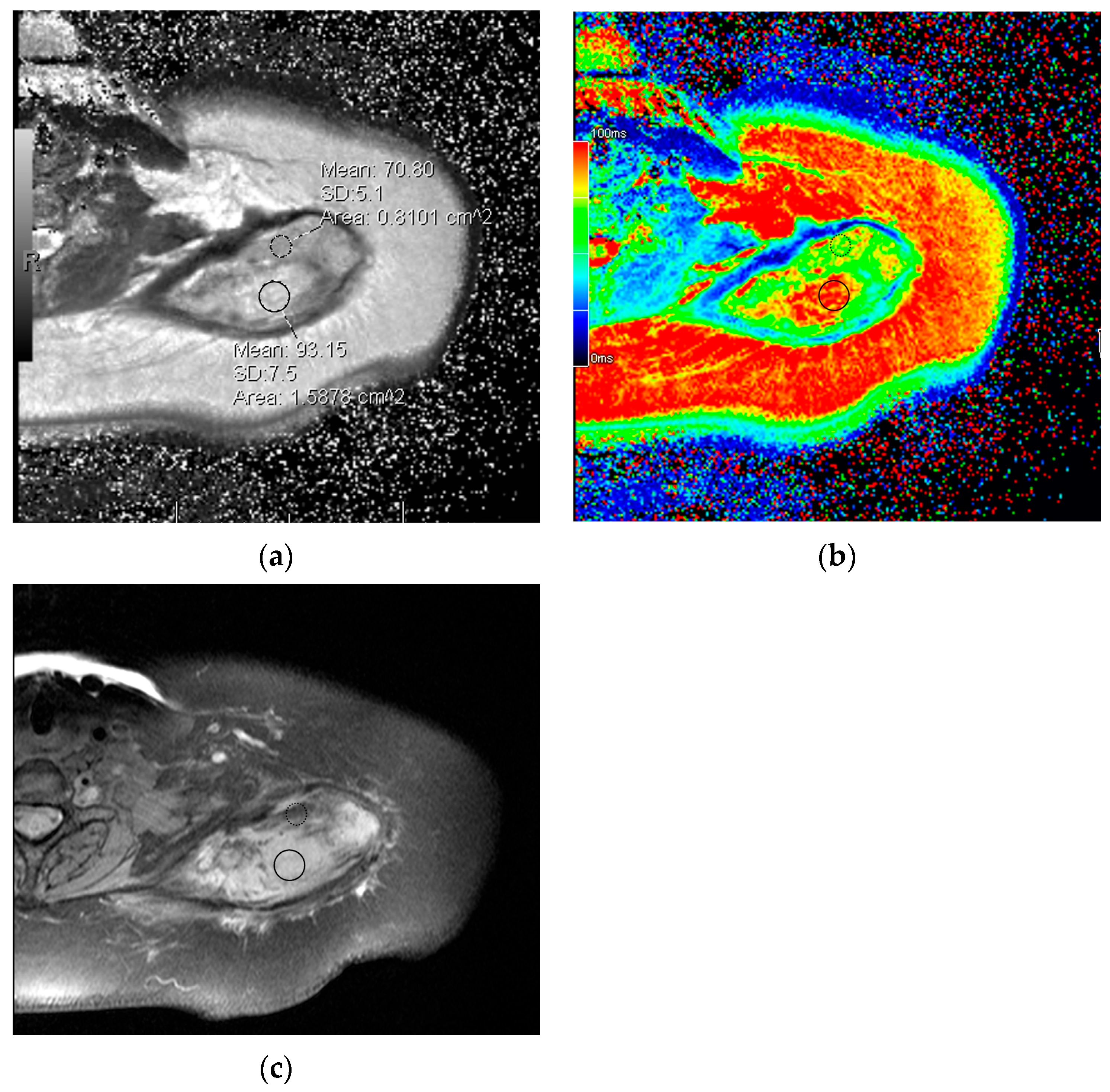 Curroncol 32 00288 g005