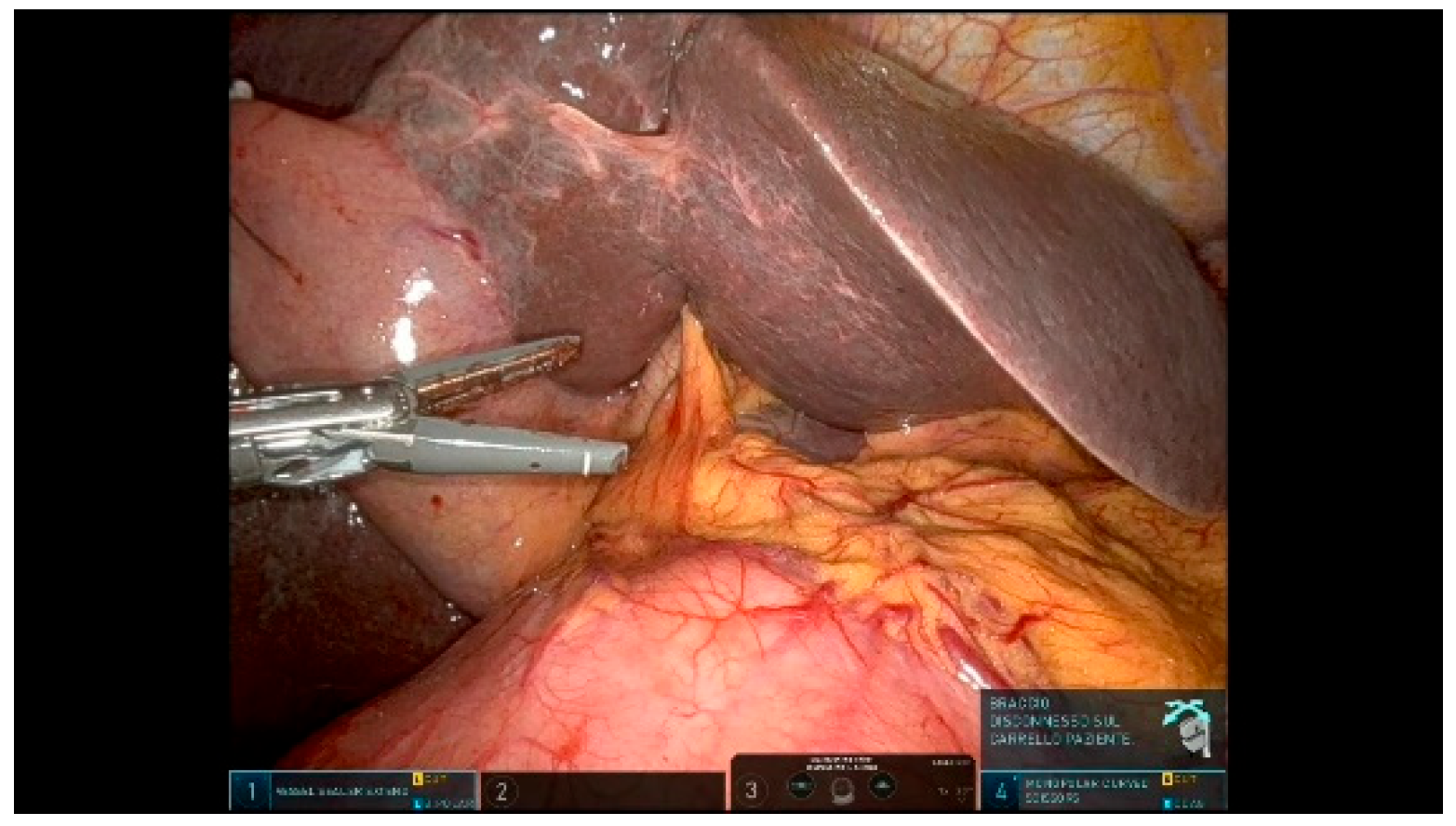 Curroncol 32 00302 g004