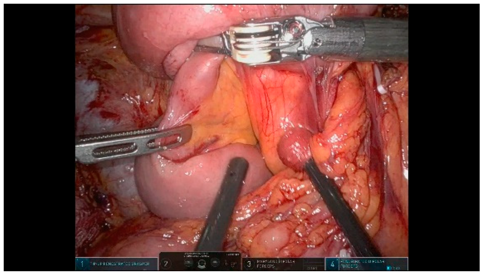 Curroncol 32 00302 g005